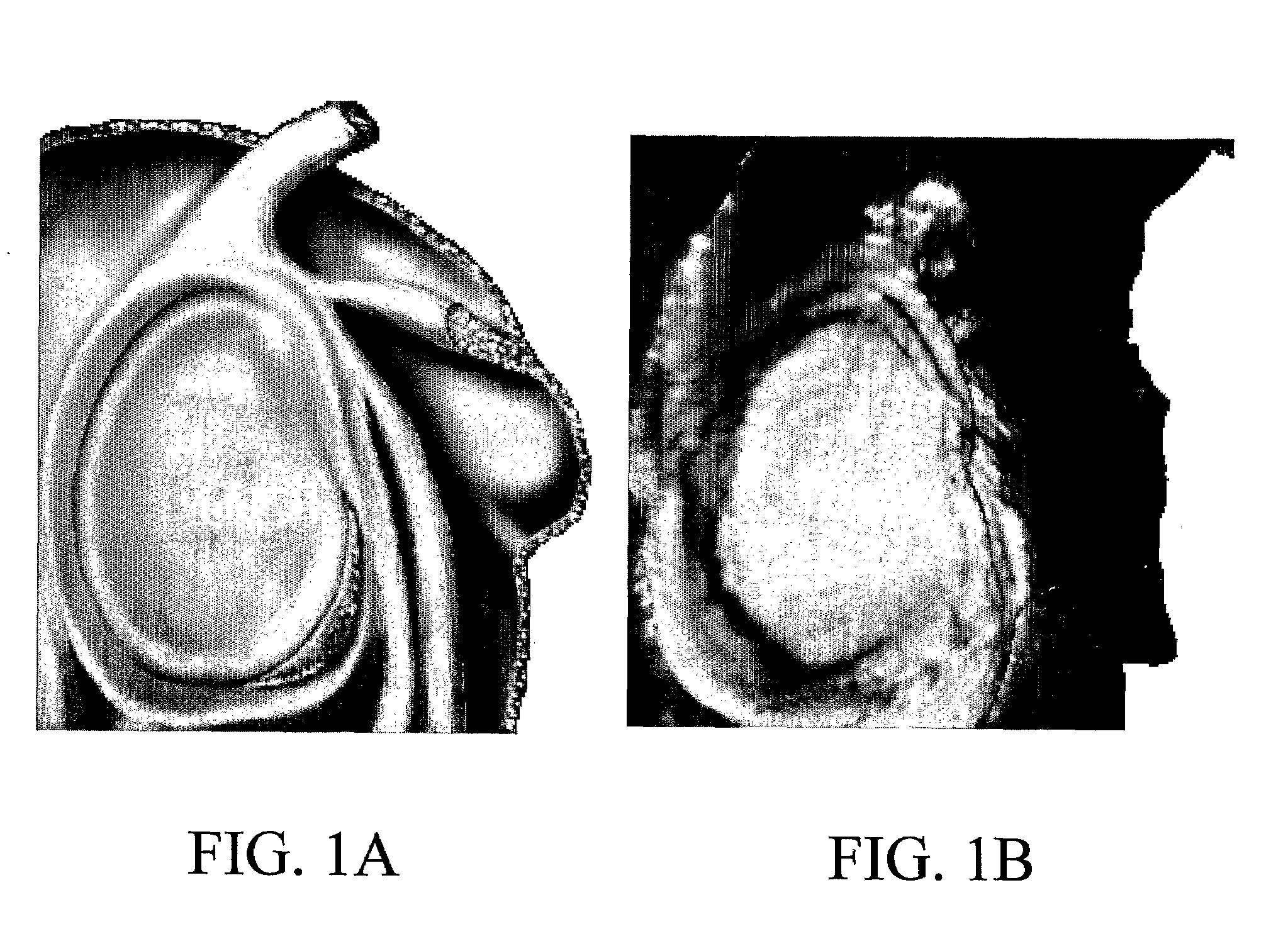 Methods, systems, and computer program products for processing three-dimensional image data to render an image from a viewpoint within or beyond an occluding region of the image data