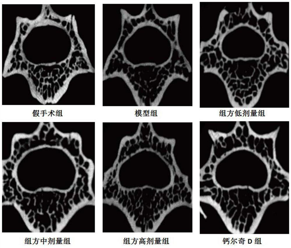 A traditional Chinese medicine active ingredient composition for the treatment of postmenopausal osteoporosis and its application