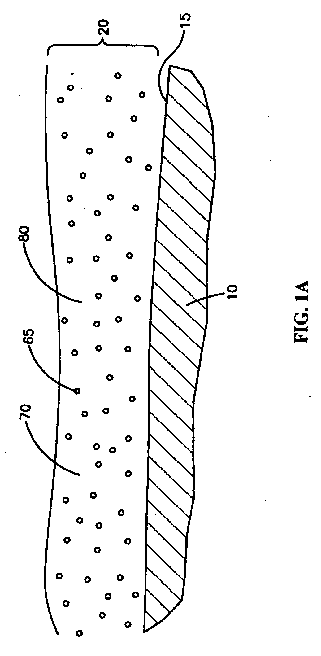 Medical devices with coatings for delivery of a therapeutic agent