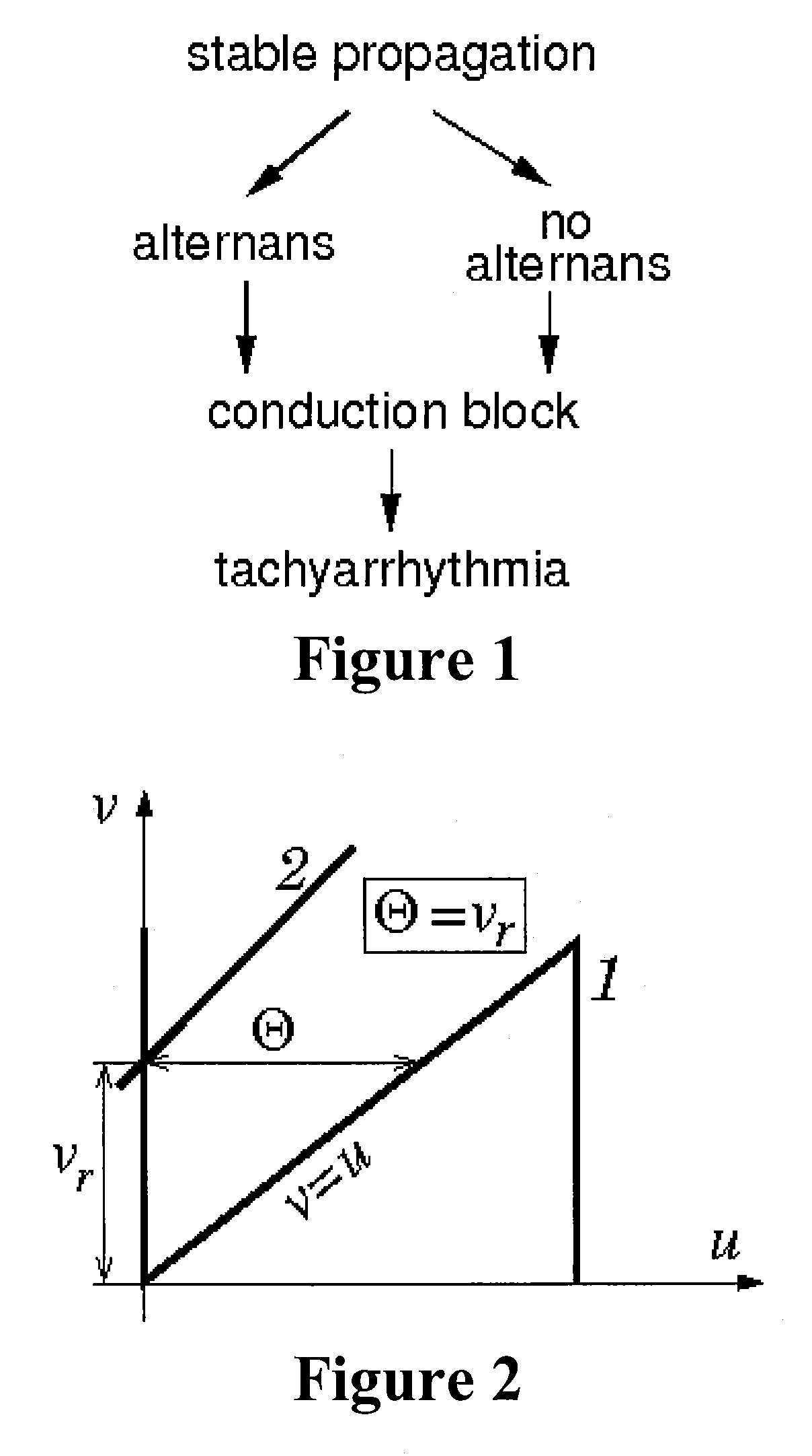 Method and system for evaluating stability of cardiac propagation reserve