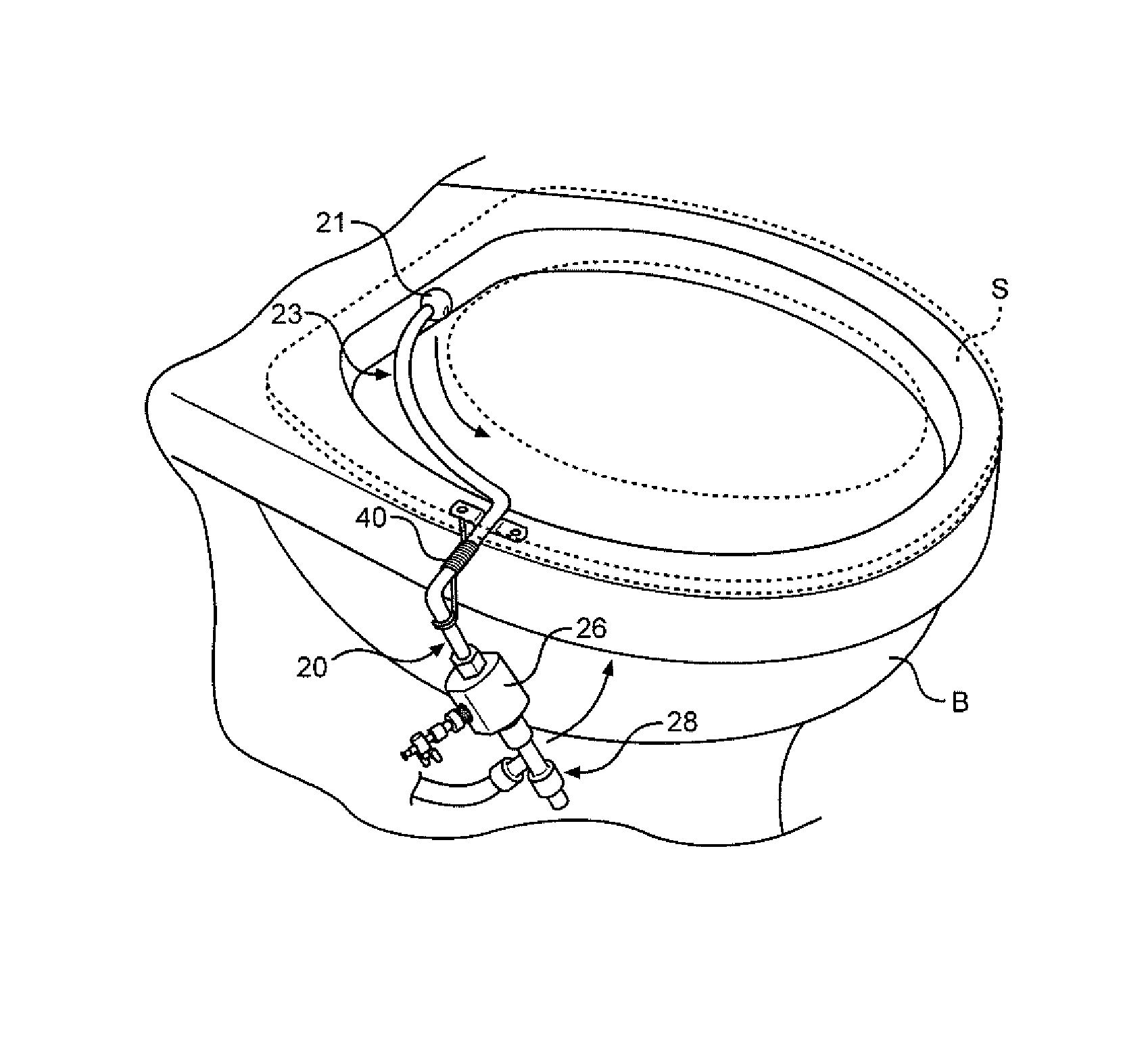 Perineal spray attachment for toilets