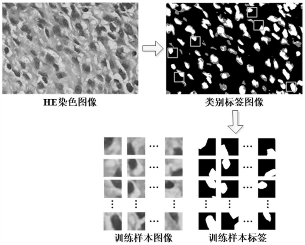 Hematoxylin-eosin staining pathological image segmentation method based on unsupervised deep learning