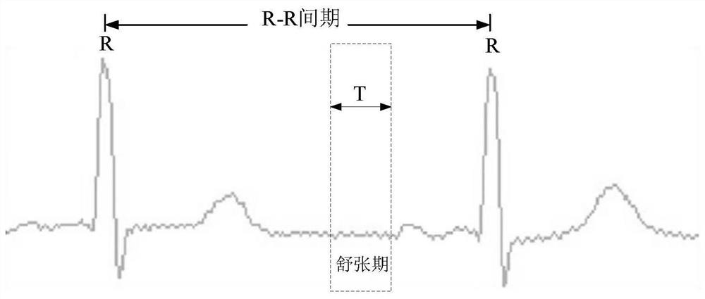 A method and device for reconstructing cardiac CT images