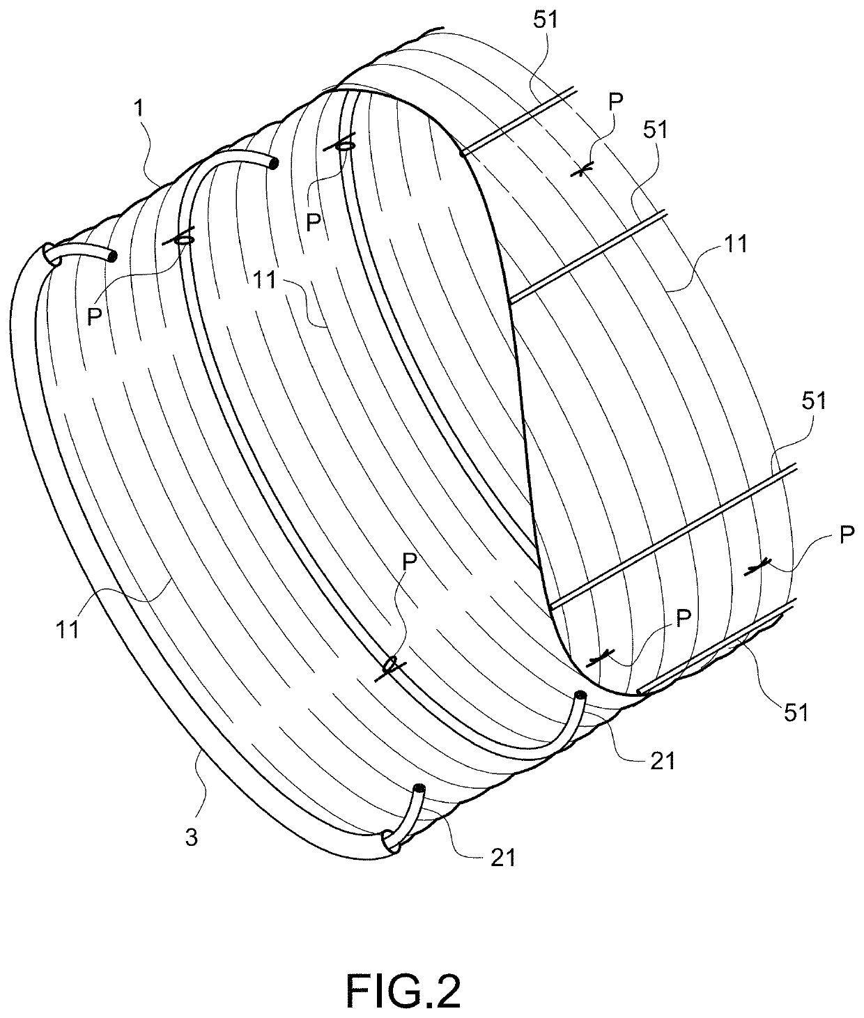 Stent-graft