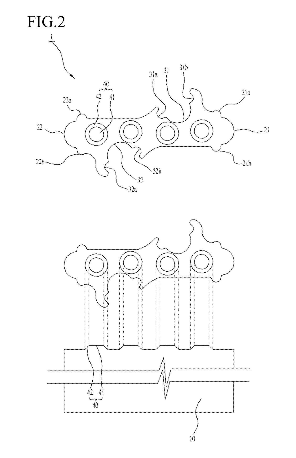 Triangle unit assembly block and method using same of building landslide preventing draining retaining wall