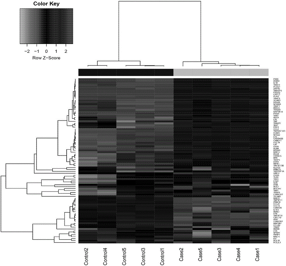 Novel mechanism for promoting human tumor generation and development