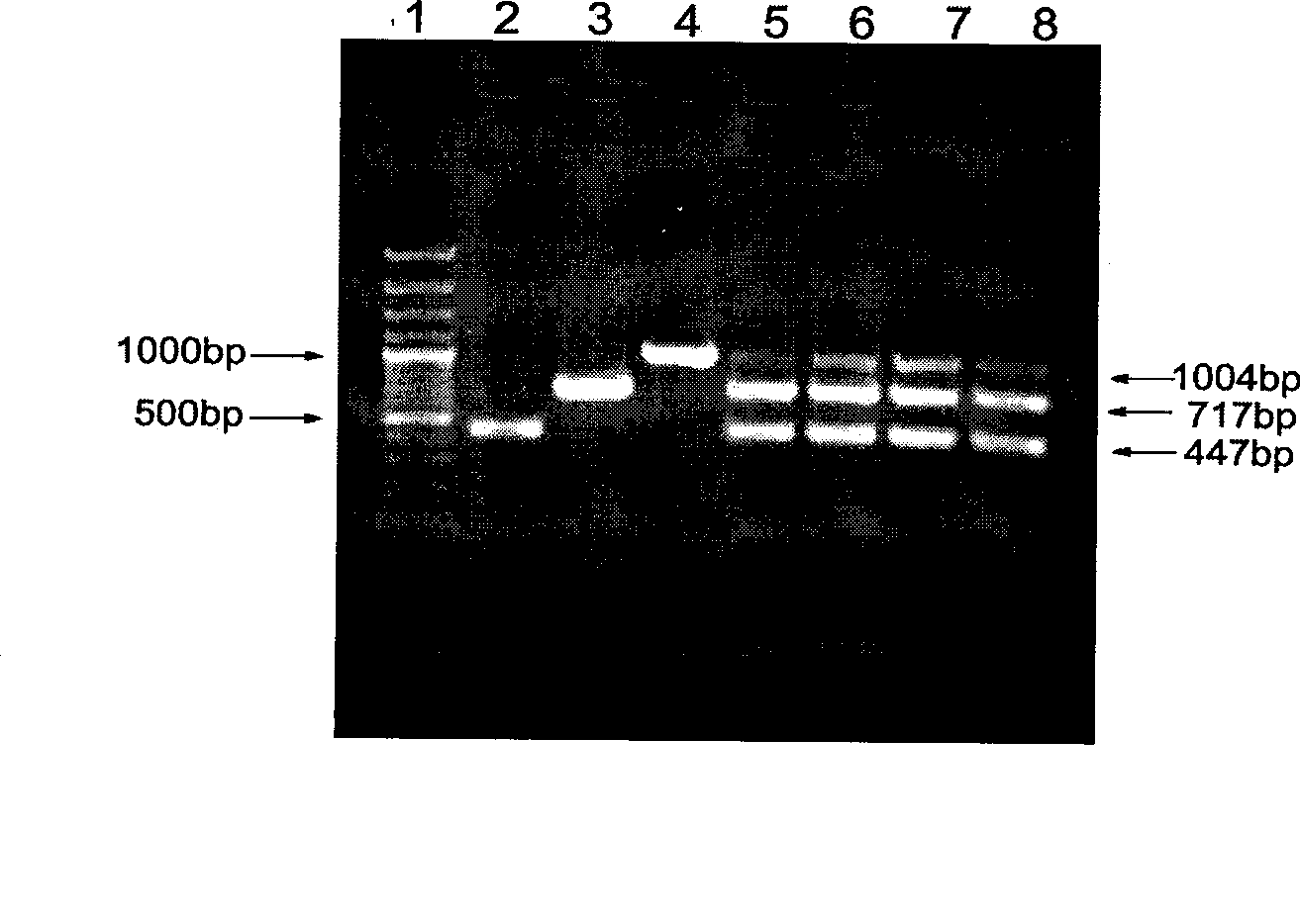 Method for detecting Francisella tularensis using multiple PCR technology