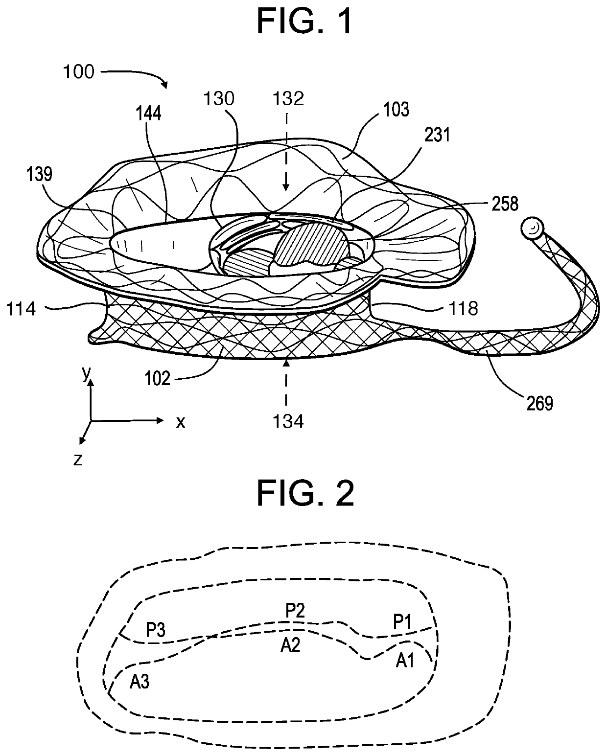 Distal subannular anchoring tab for side-delivered transcatheter valve prosthesis