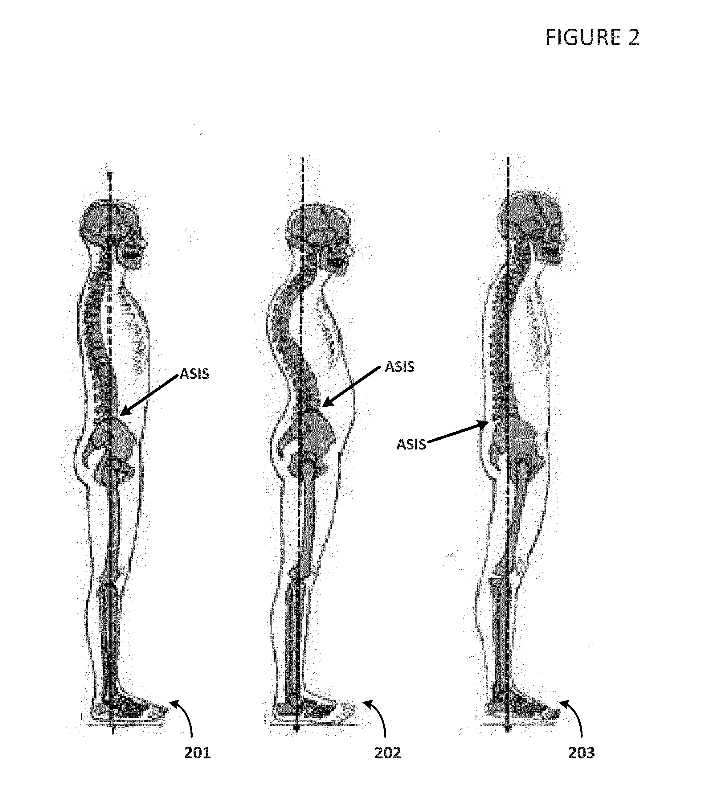 System and Method of Biomechanical Posture Detection and Feedback Including Sensor Normalization
