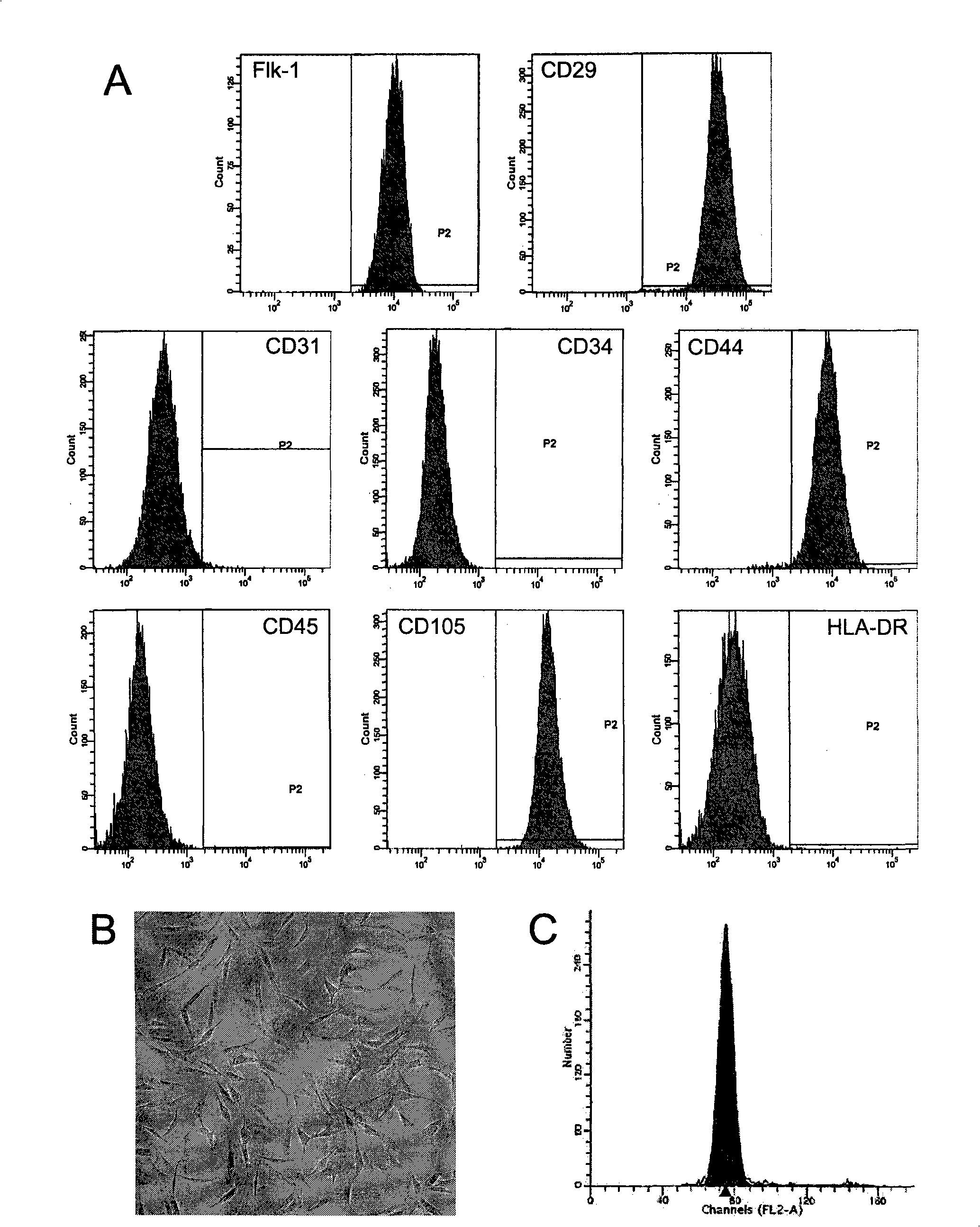 Method for isolated culture of human fat mesenchyma stem cell and special culture medium thereof