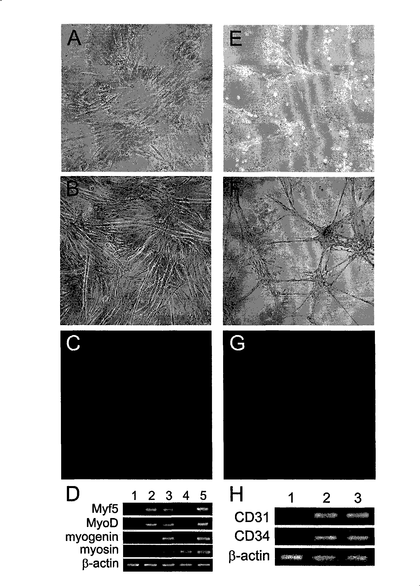 Method for isolated culture of human fat mesenchyma stem cell and special culture medium thereof