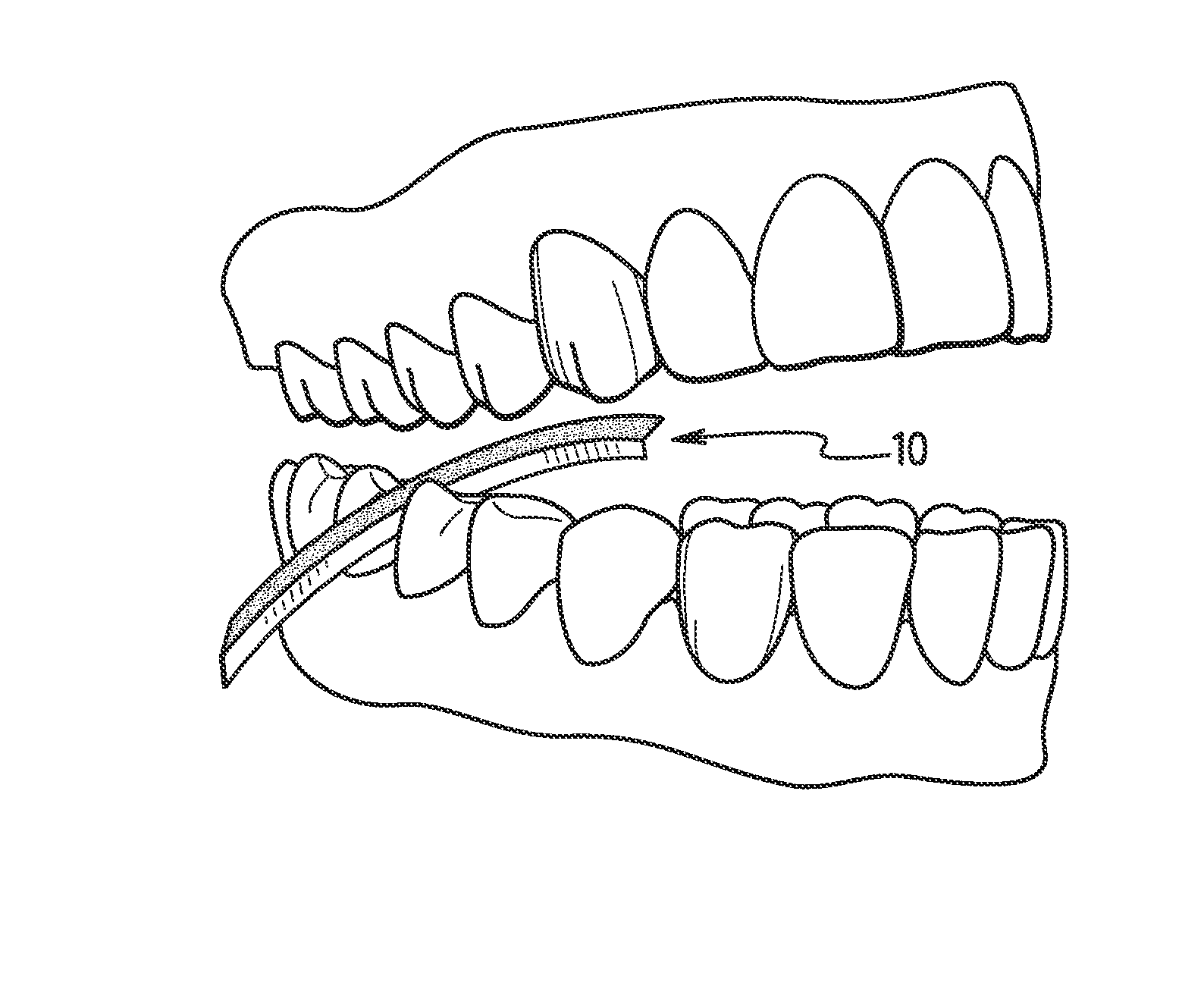 Dental shaping strip