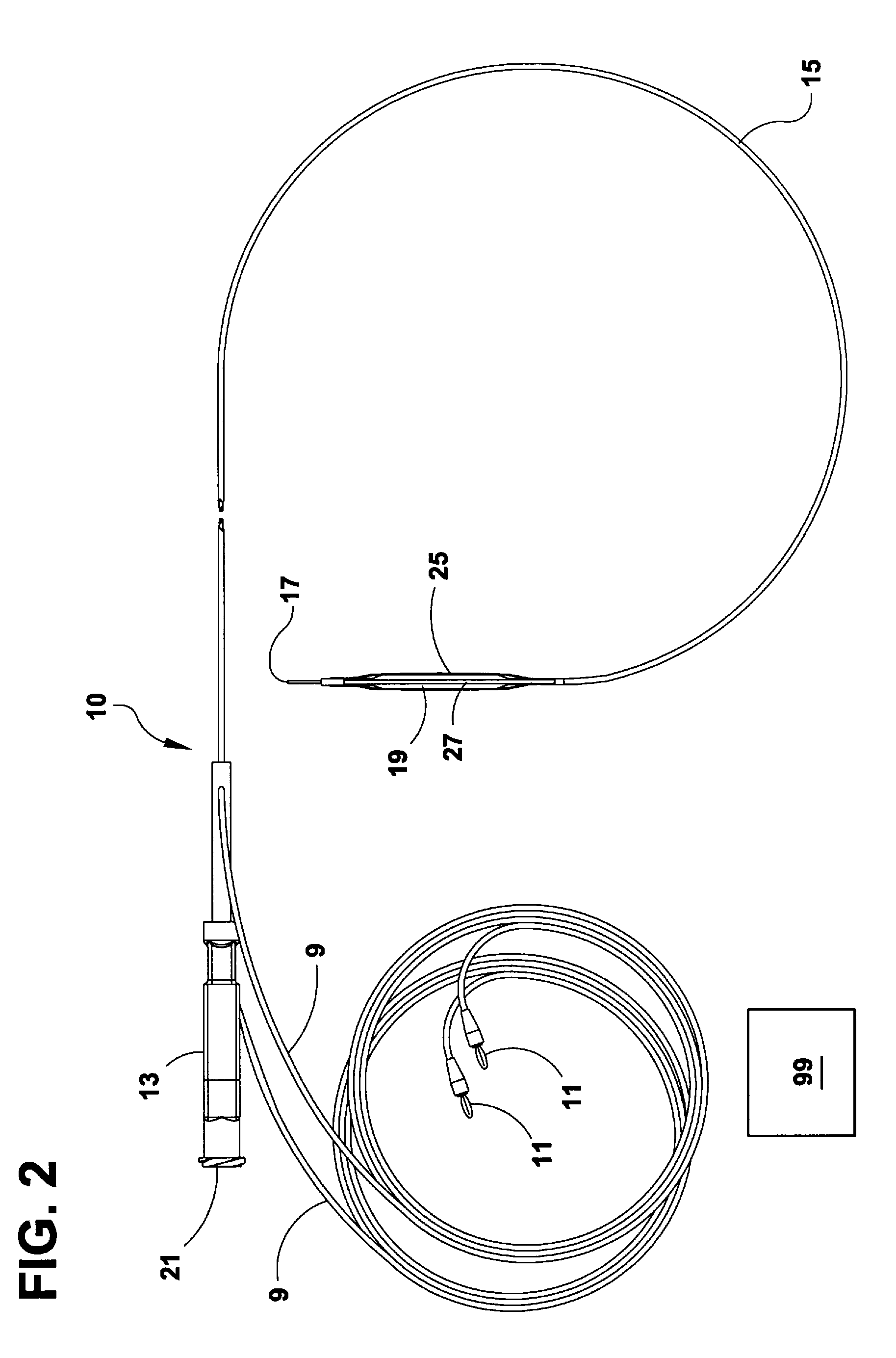 Method for Treatment of Complications Associated with Arteriovenous Grafts and Fistulas Using Electroporation