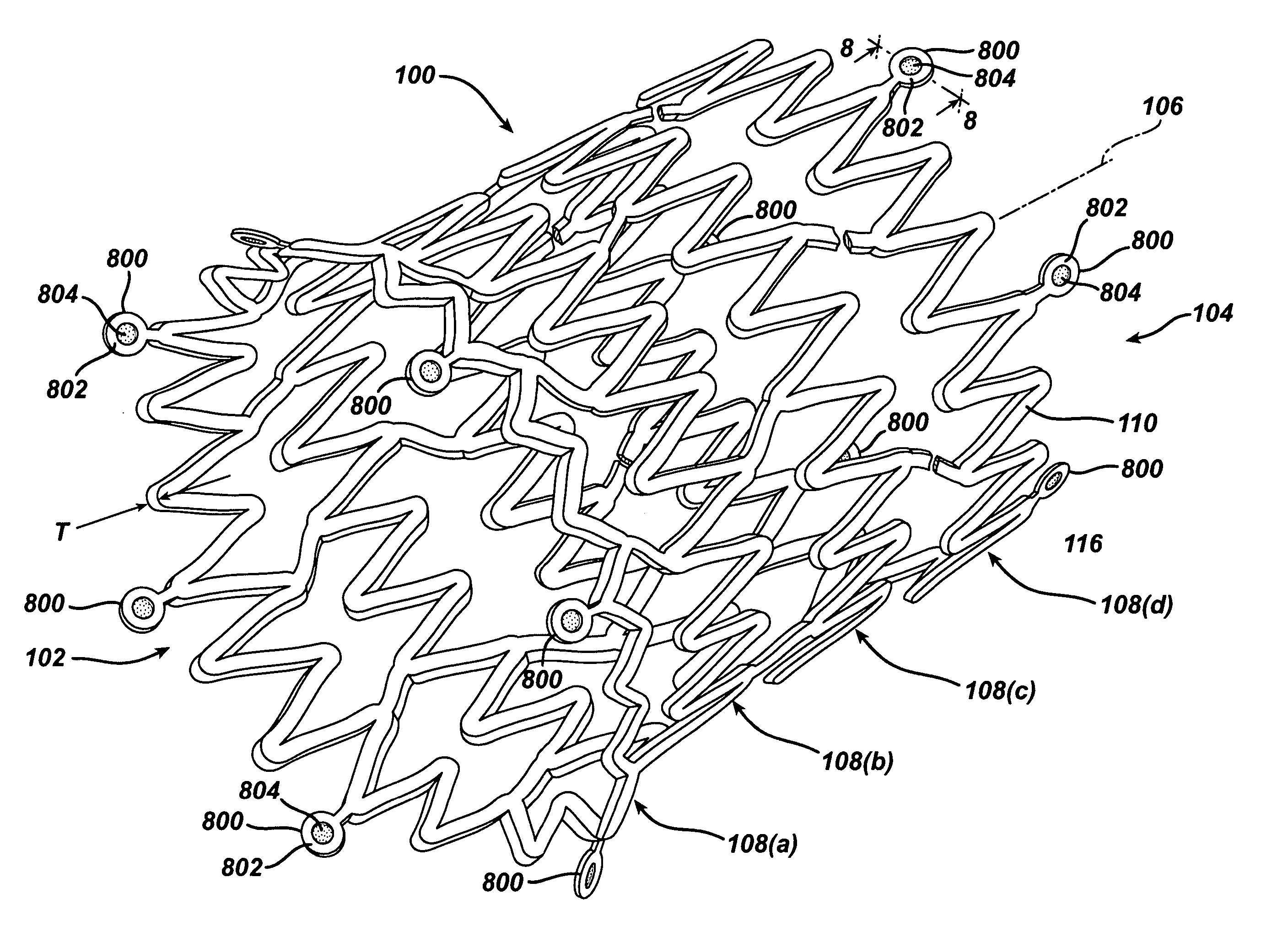 Stent design having stent segments which uncouple upon deployment