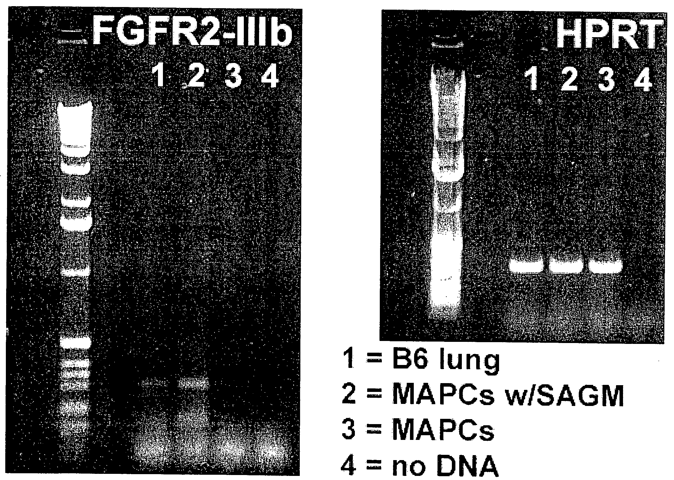 Mapc Generation of Lung Tissue