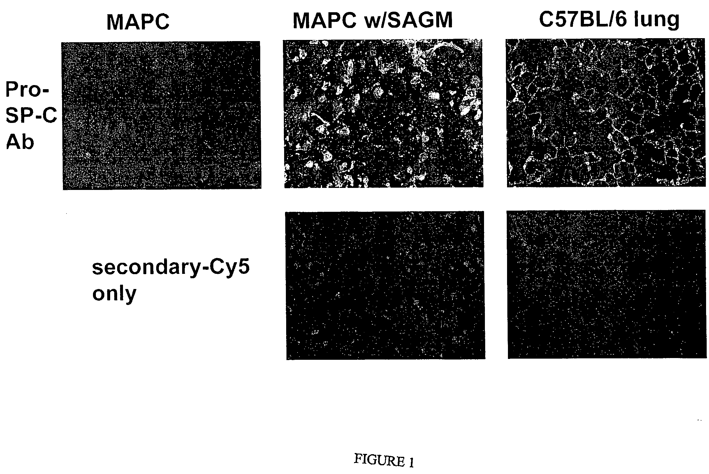 Mapc Generation of Lung Tissue