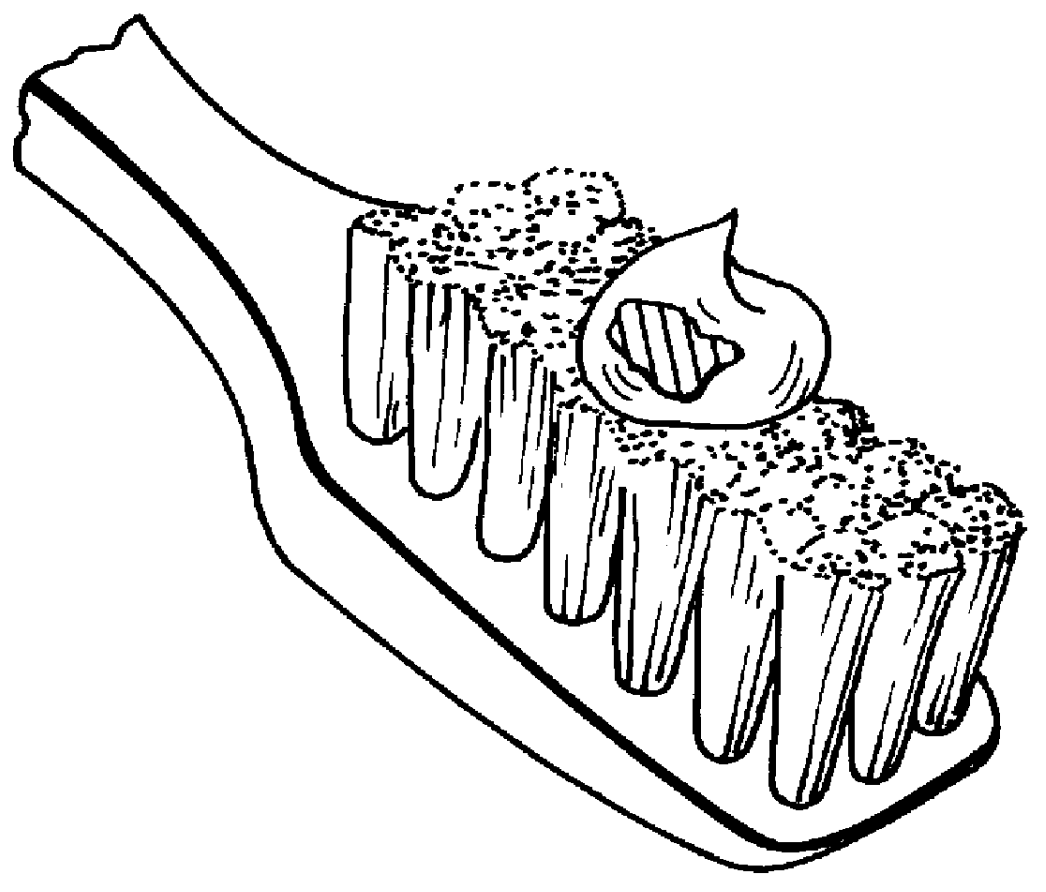 Delivery system for dental agents