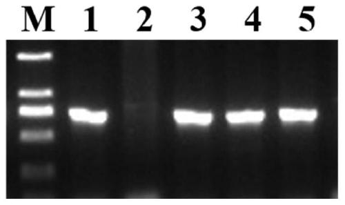 Rice OsNBARC1 protein and application of coding gene of rice OsNBARC1 protein in regulation and control of resistance of rice to bacterial leaf blight