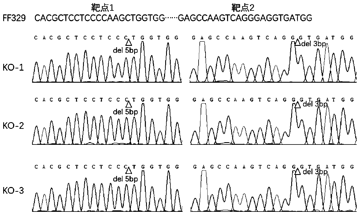 Rice OsNBARC1 protein and application of coding gene of rice OsNBARC1 protein in regulation and control of resistance of rice to bacterial leaf blight