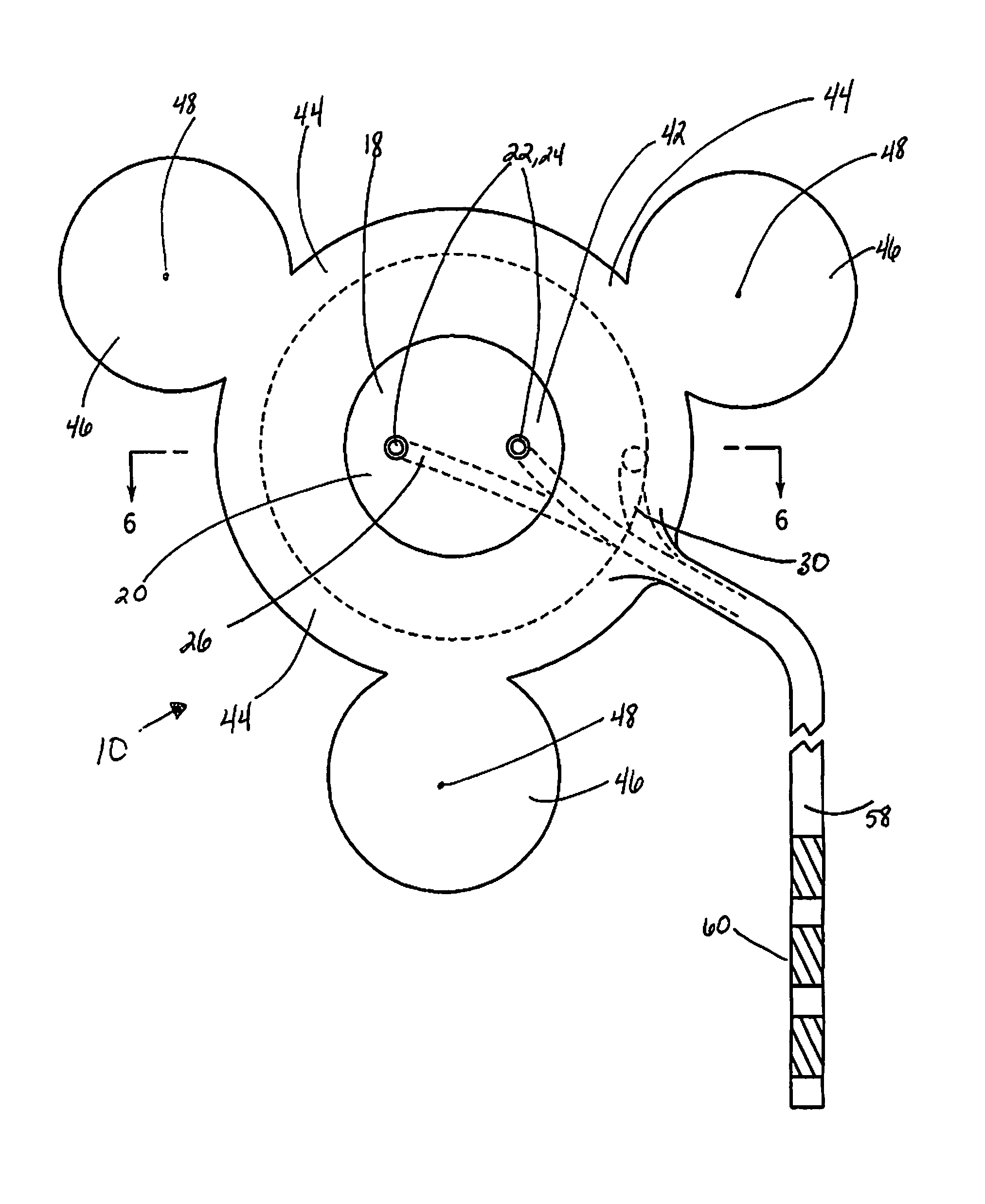Intracranial sensing and monitoring device with macro and micro electrodes