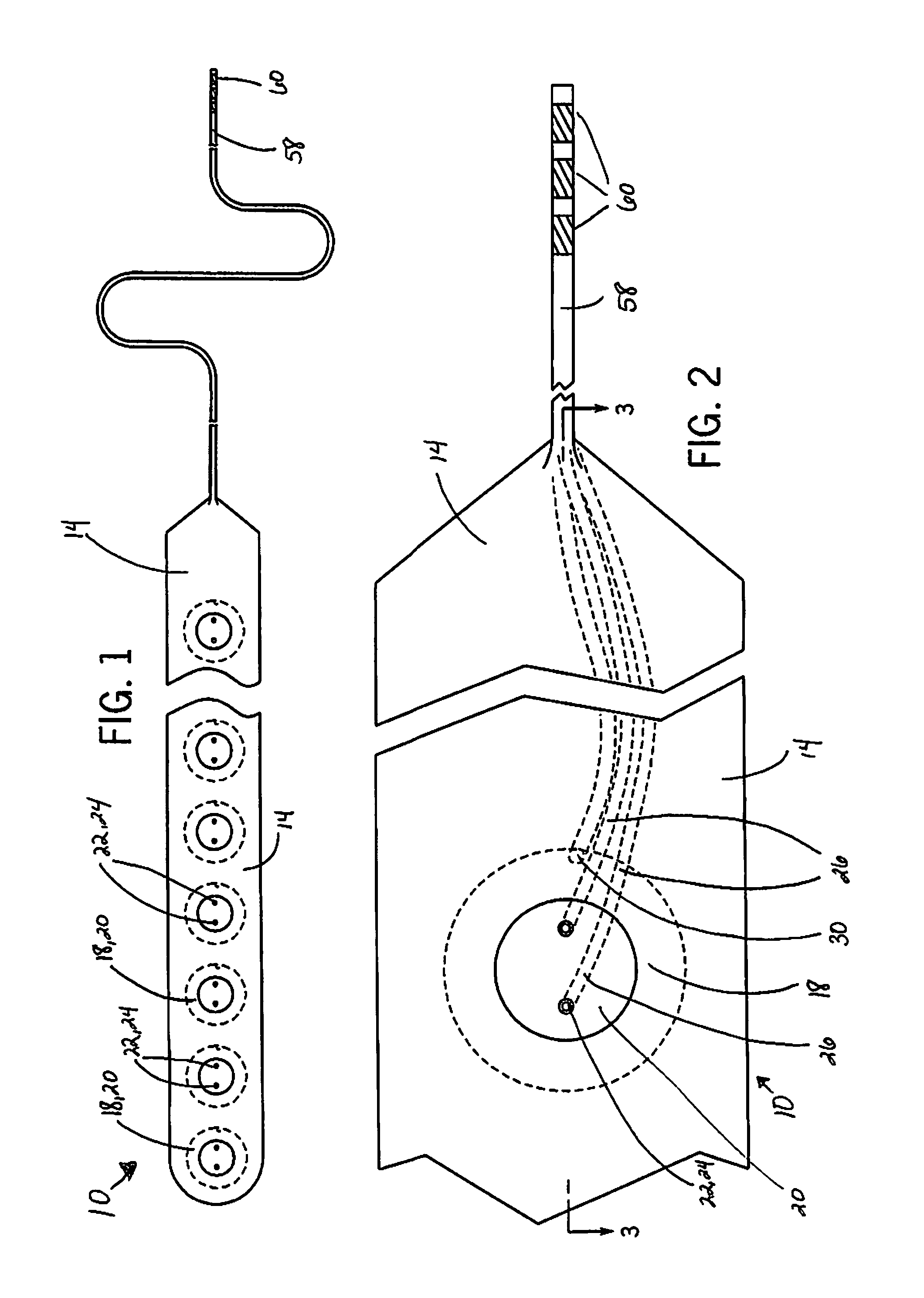 Intracranial sensing and monitoring device with macro and micro electrodes