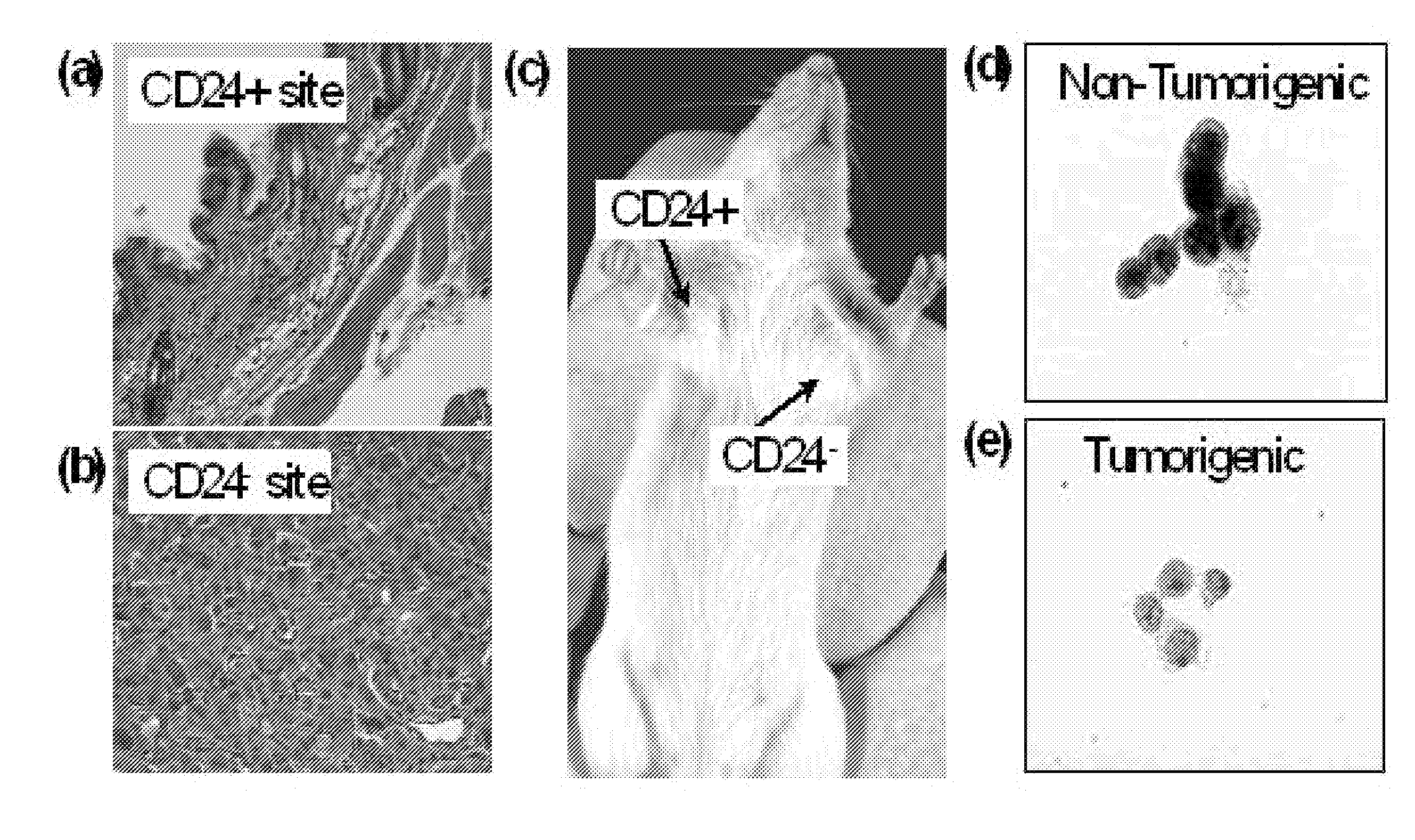 Compositions and methods for treating and diagnosing cancer
