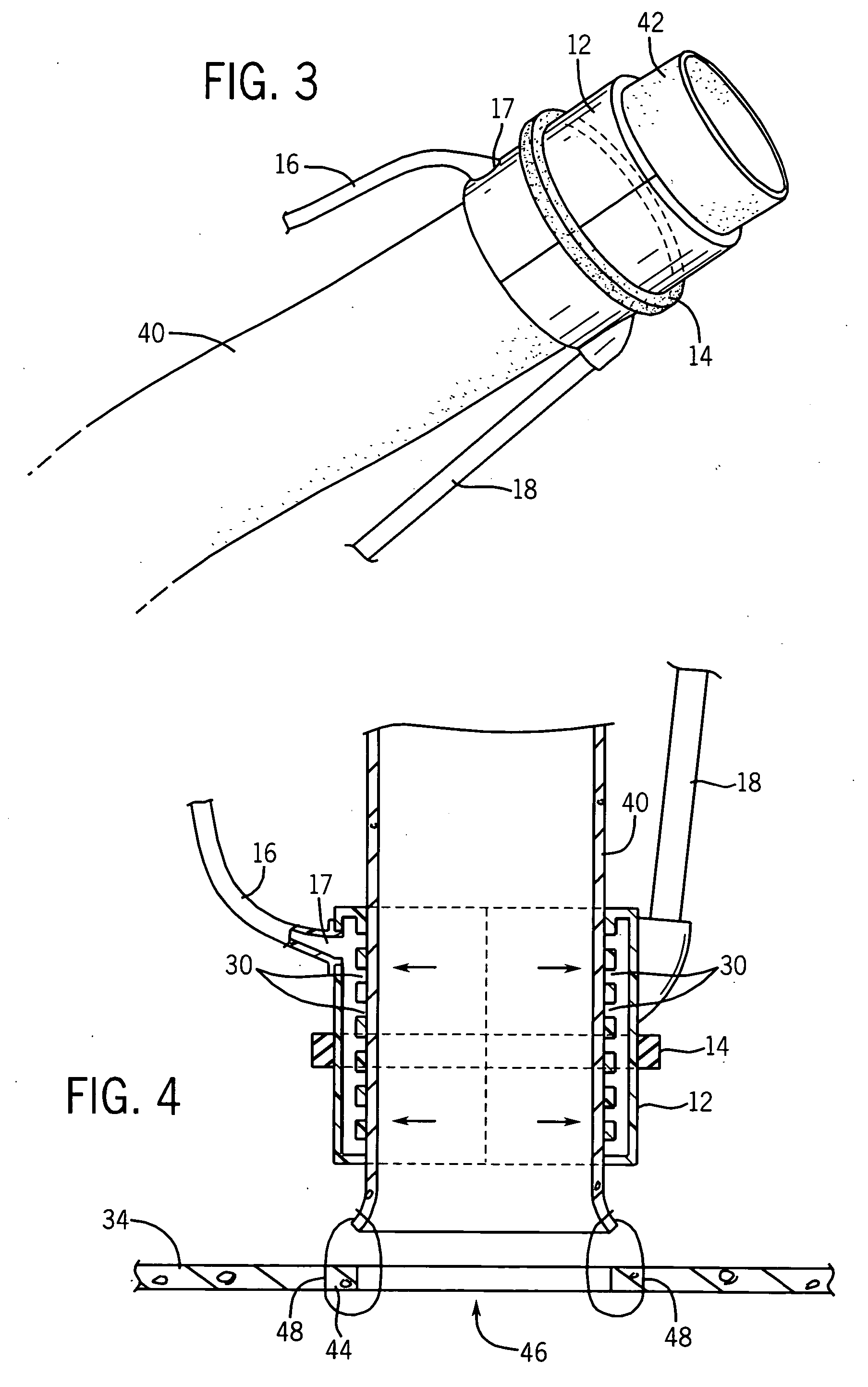 Blood vessel holding and positioning system
