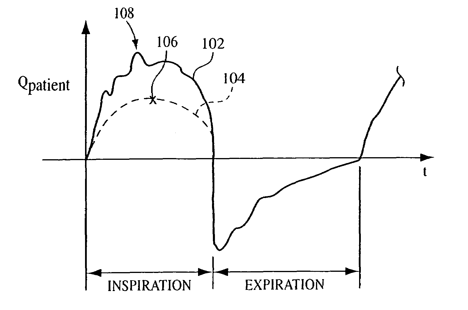 Method and apparatus for treating Cheyne-Stokes respiration