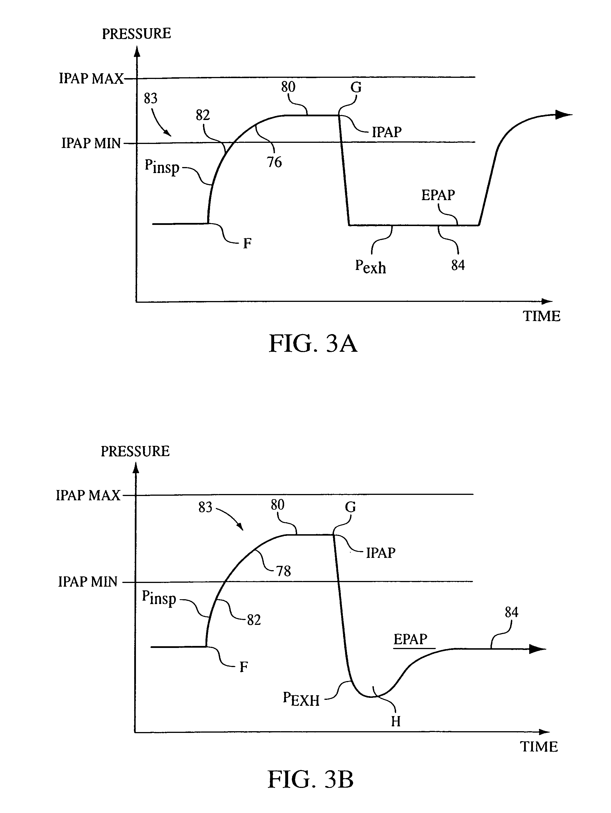 Method and apparatus for treating Cheyne-Stokes respiration