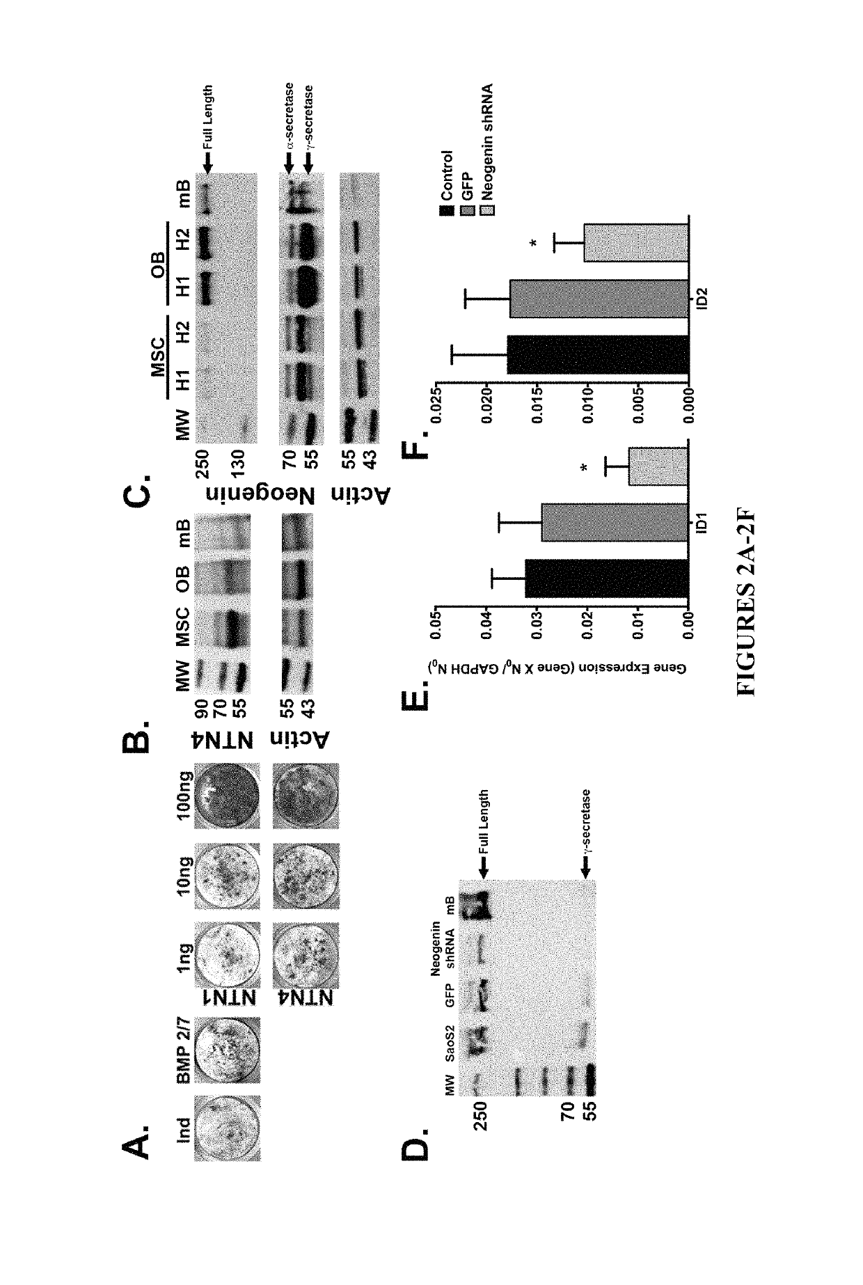 Neurogenic regulation of bone growth and bone degradation