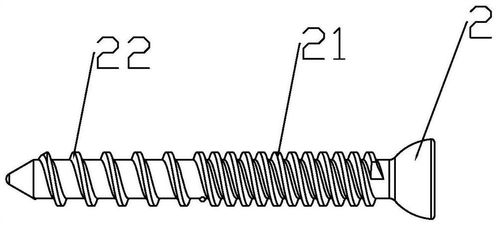 Tibia defect patch set and using method thereof