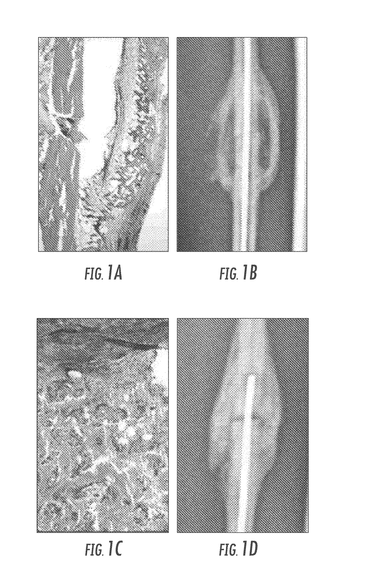 Matrix for enhanced delivery of osteoinductive molecules in bone repair