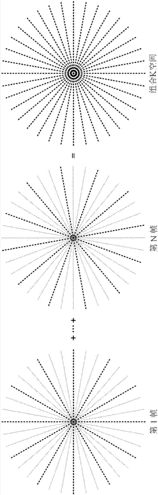 Magnetic resonance dynamic imaging sampling method and image reconstruction methods