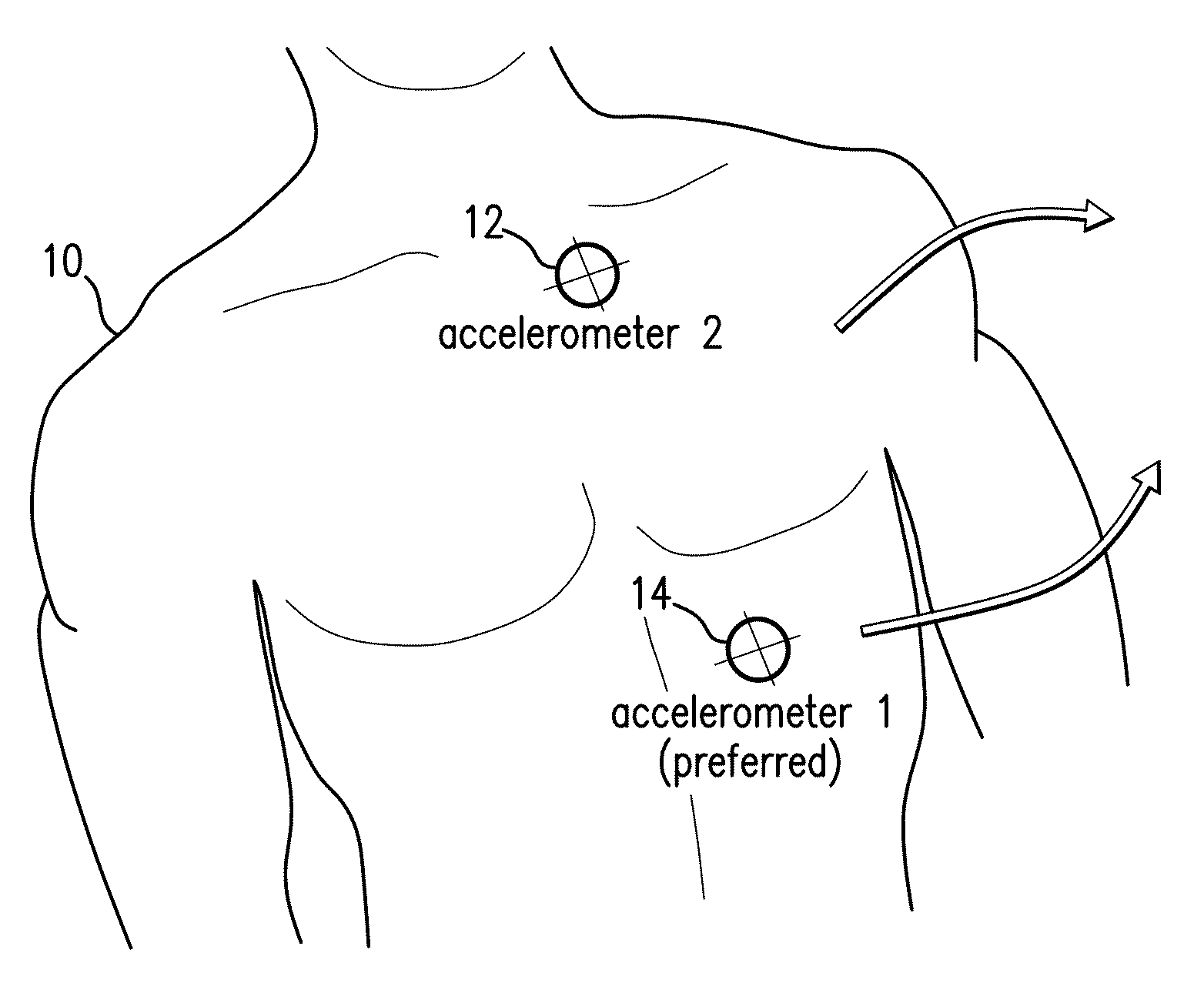 Body-worn monitor for measuring respiration rate