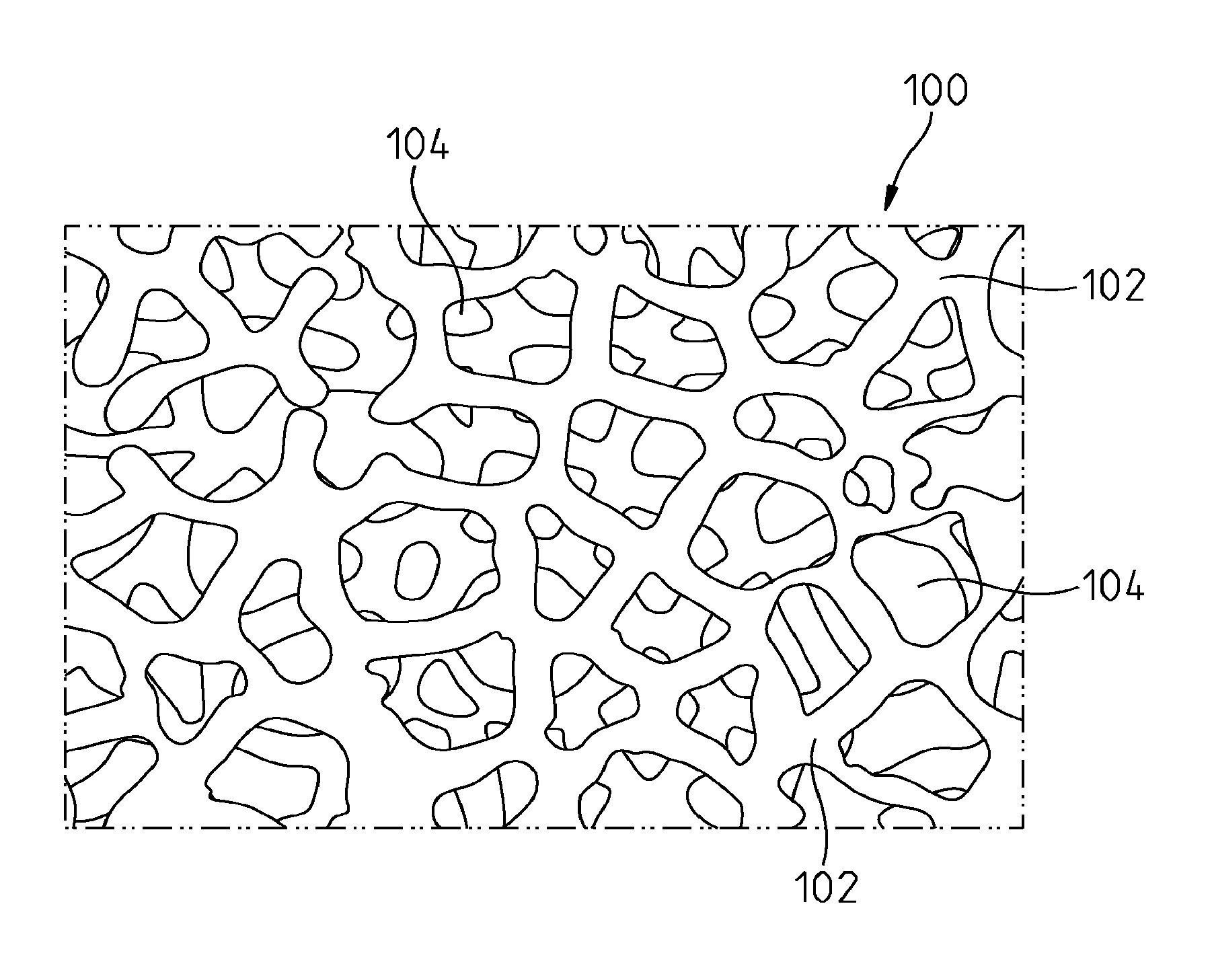 Porous metal implants with bone cement