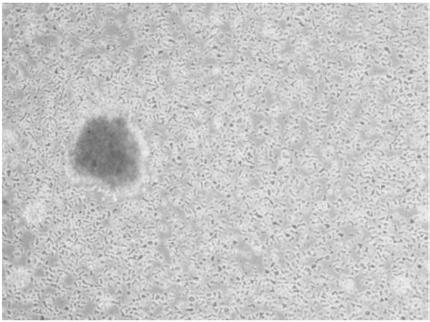 Method for screening tumor specific T cell from TIL (tumor infiltrating lymphocyte)