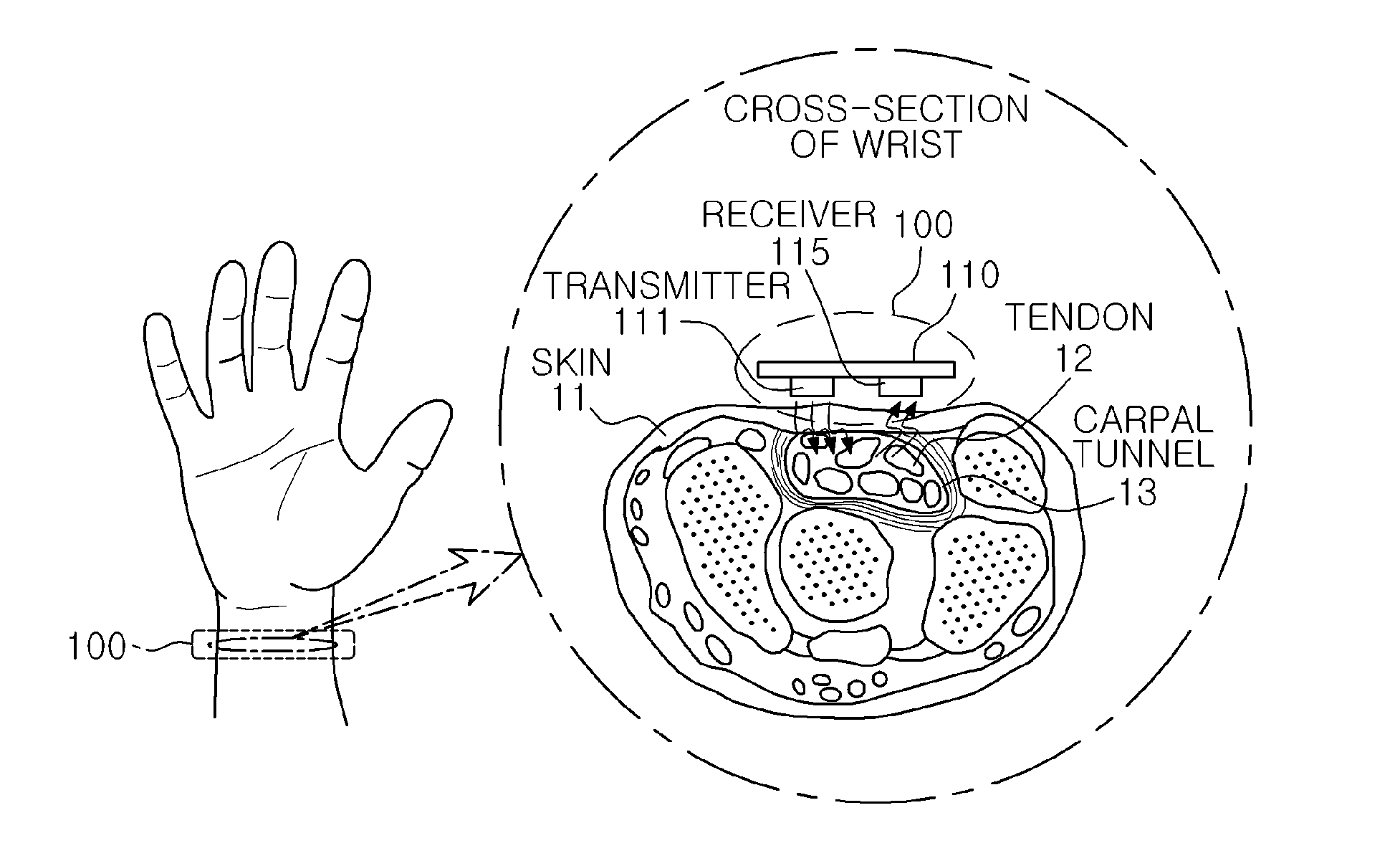 Finger motion detecting apparatus and method
