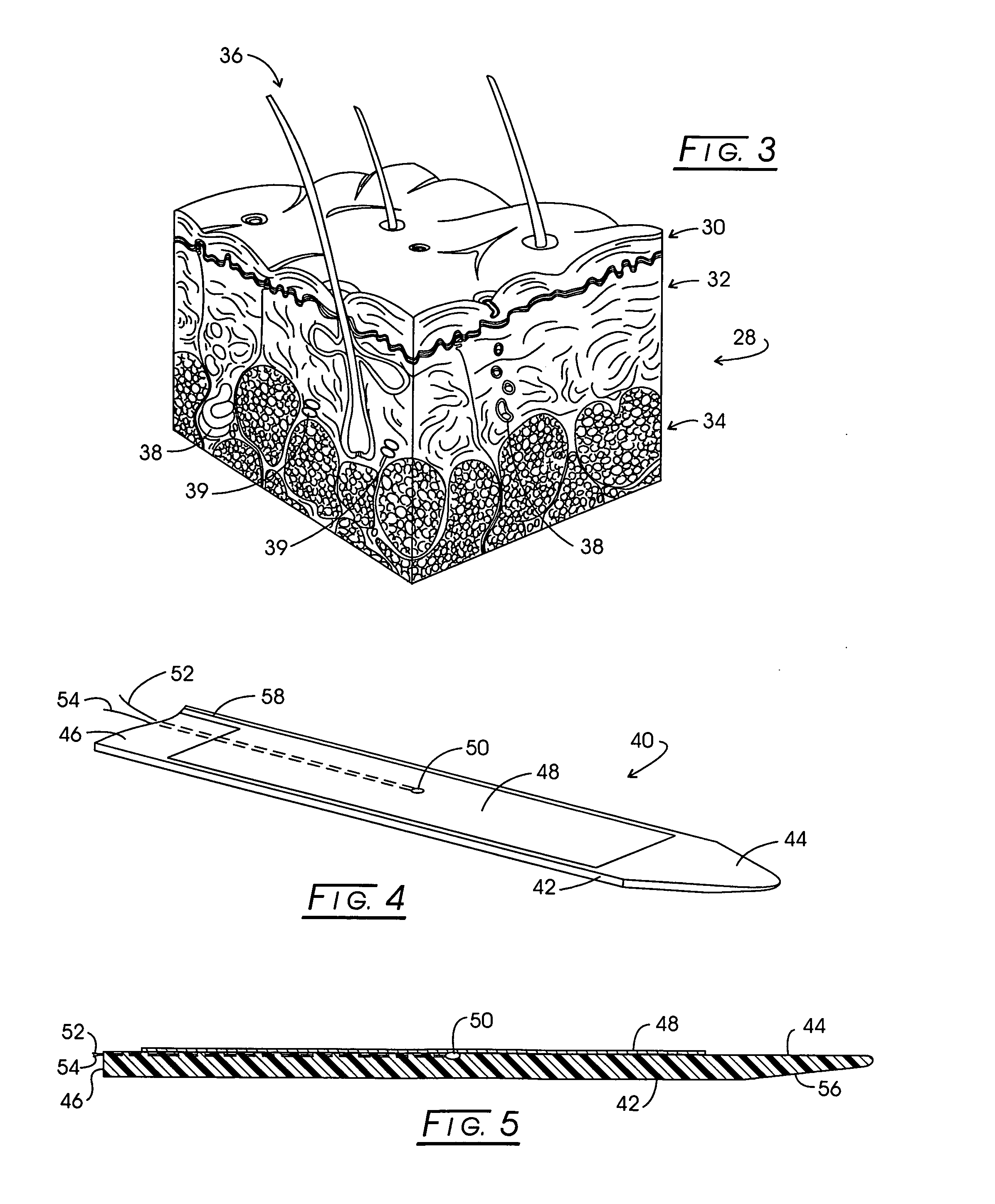 Method and apparatus for carrying out the controlled heating of tissue in the region of dermis