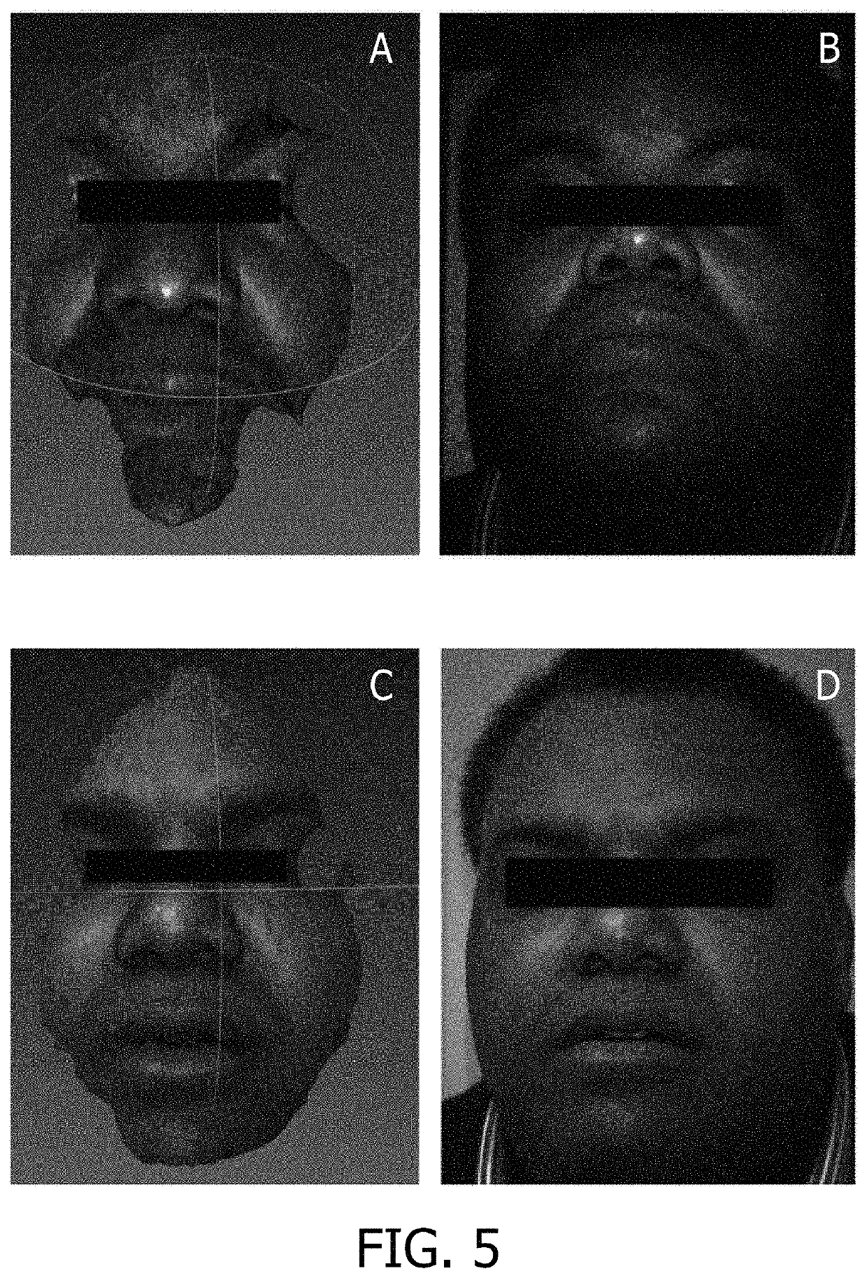 System and method for 3D scanning