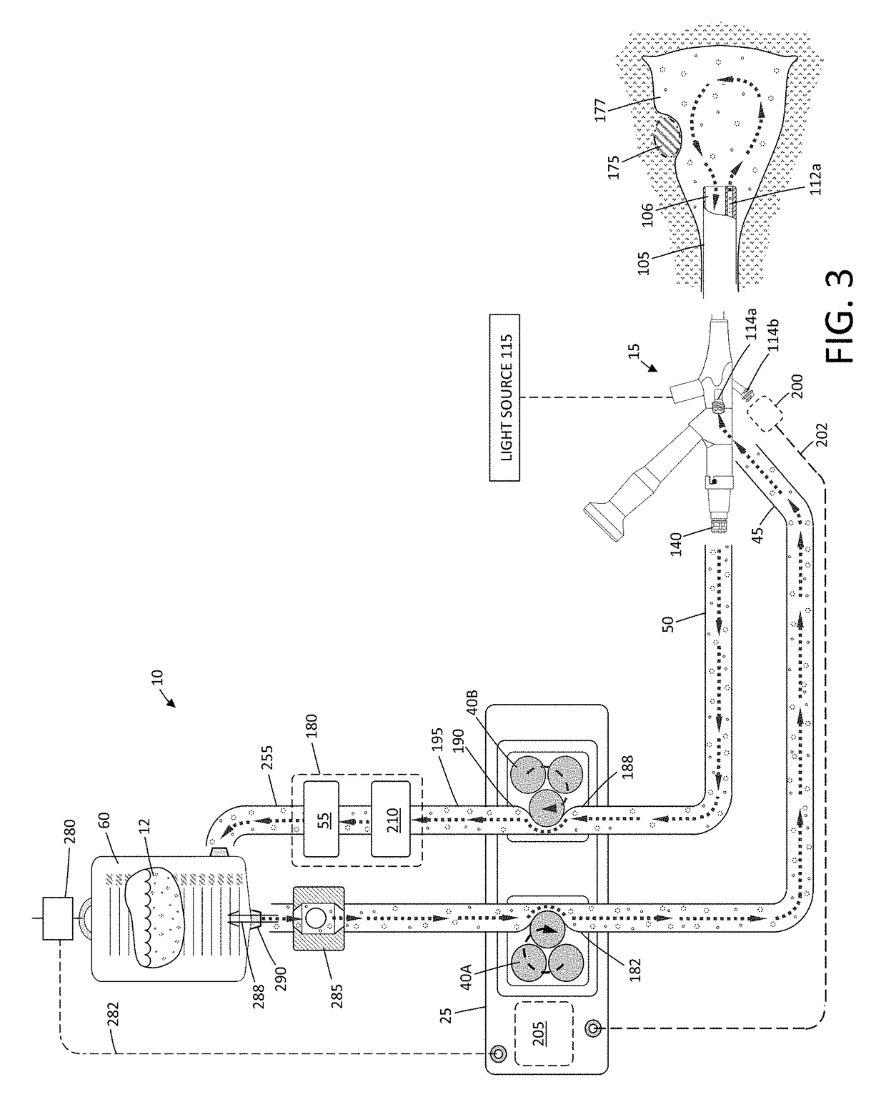 Fluid management system and methods