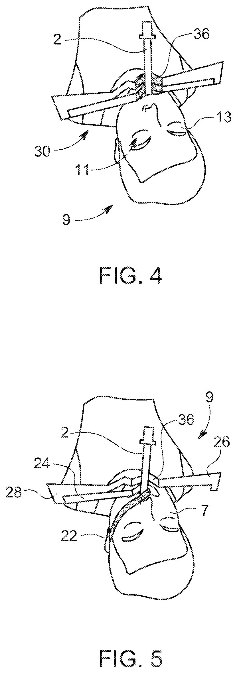 Airway and Eye Taping System and Method of Its Use