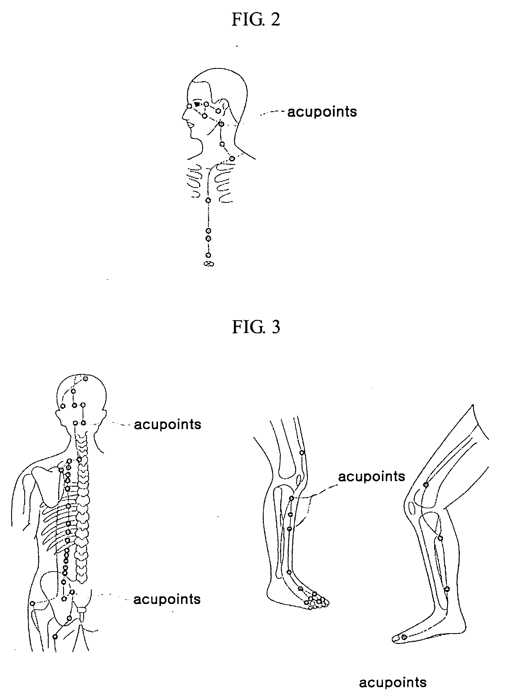 Method for treating disease using motion style treatment