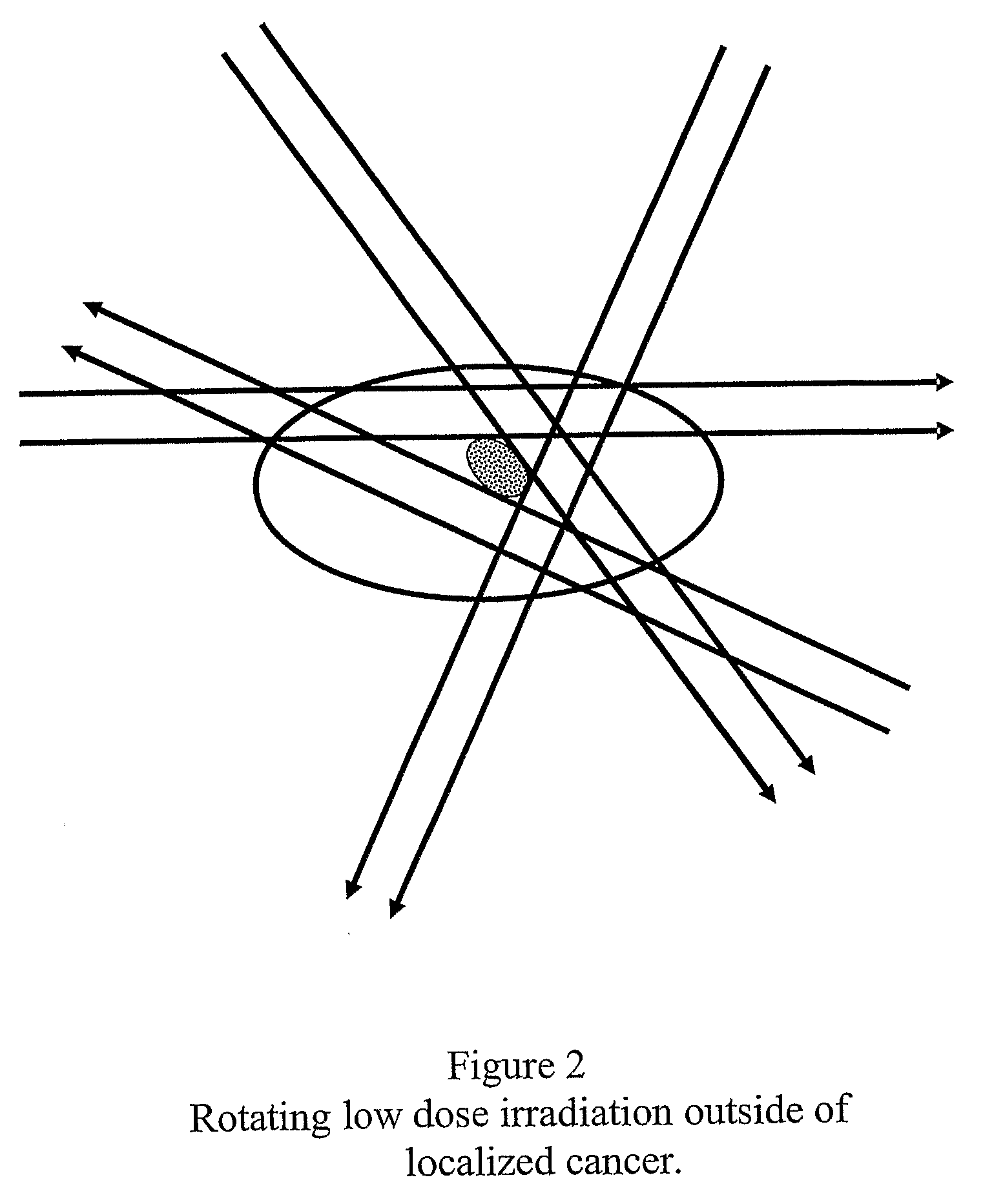 Computer prescribed treatment to reduced damage from radiation therapy and chemotherapy