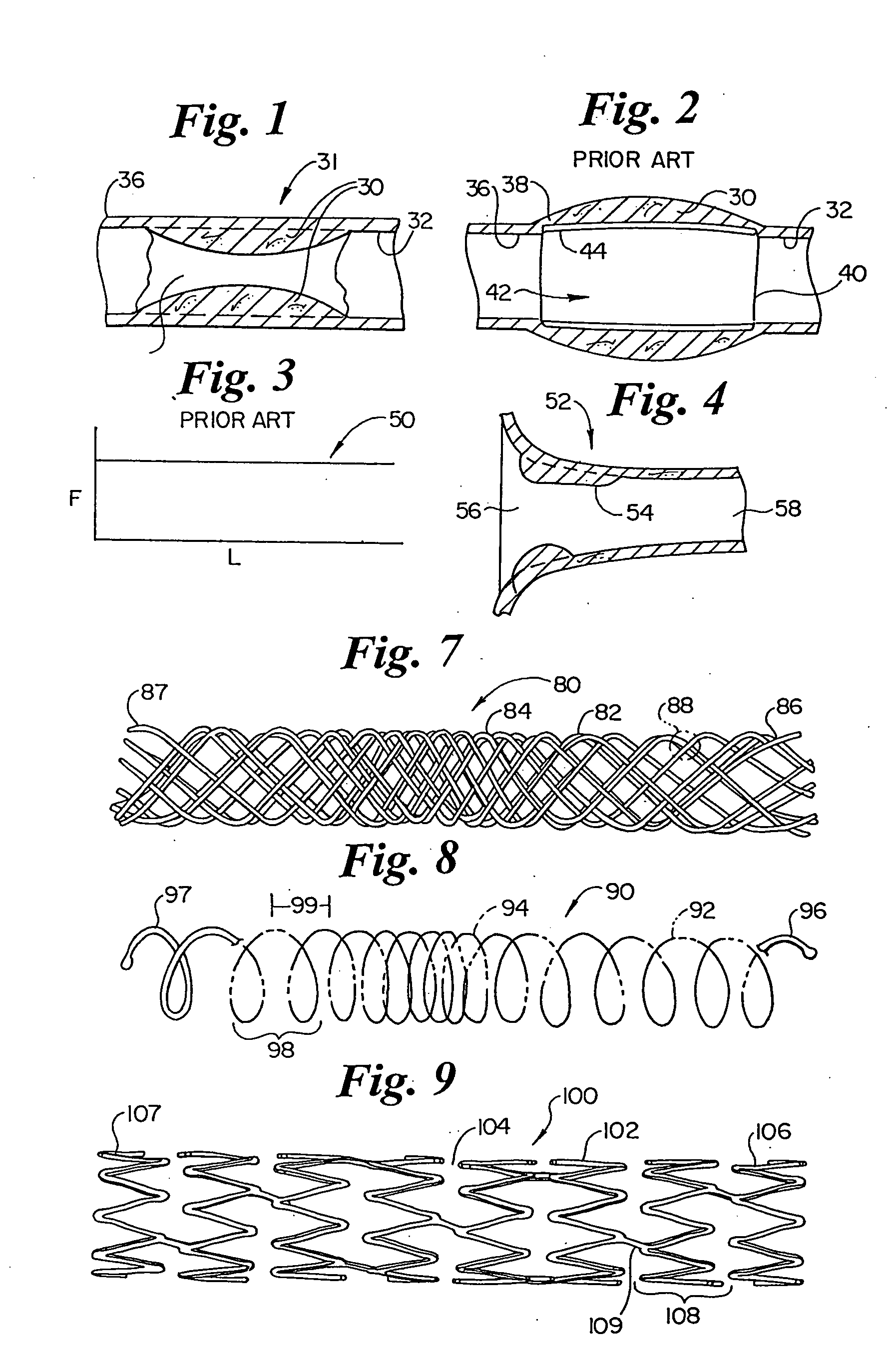 Variable expansion force stent