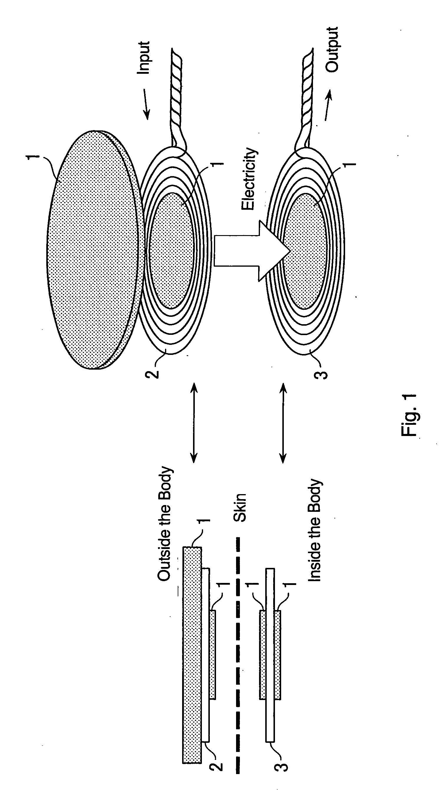 Device for electrically stimulating stomach