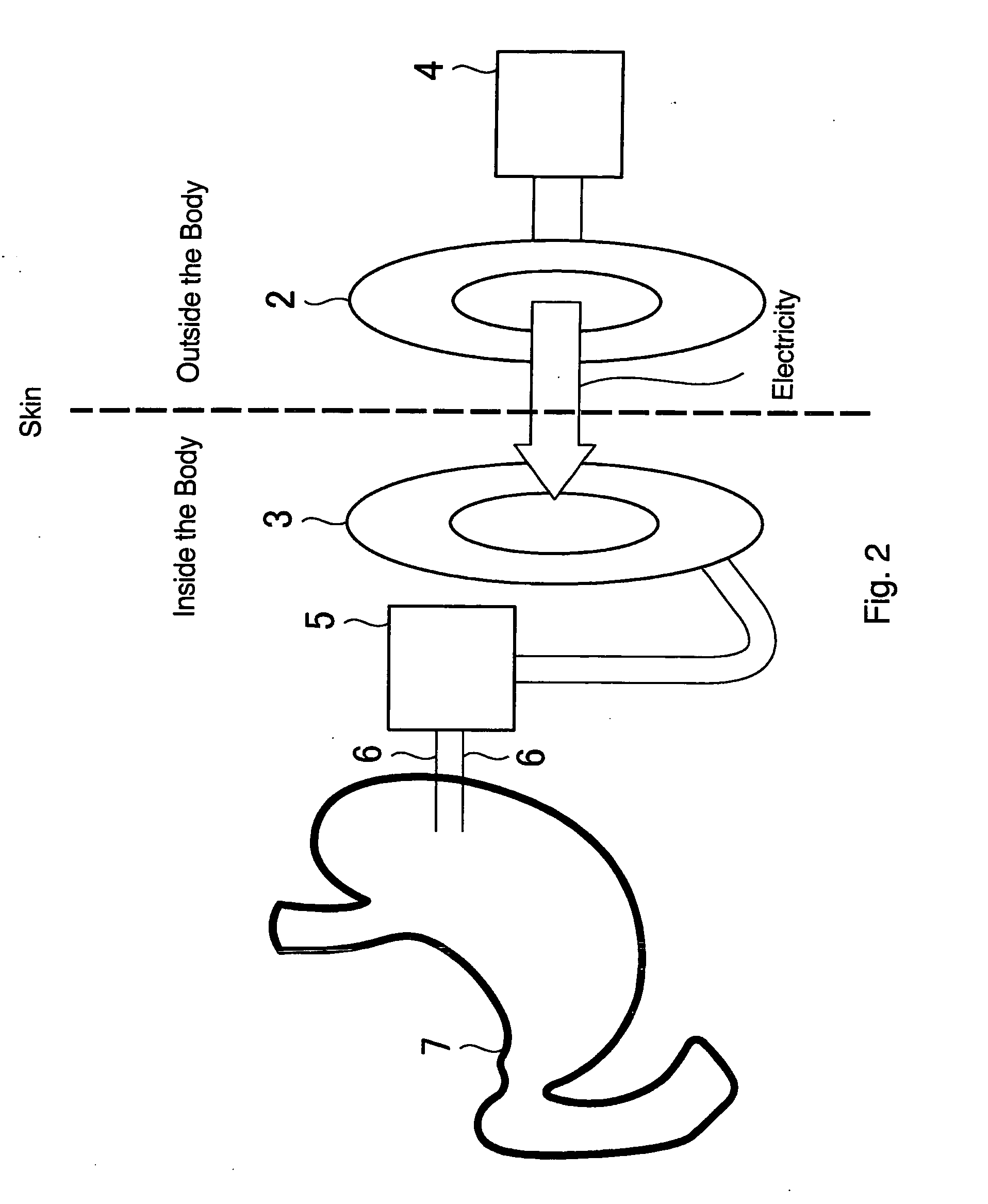 Device for electrically stimulating stomach
