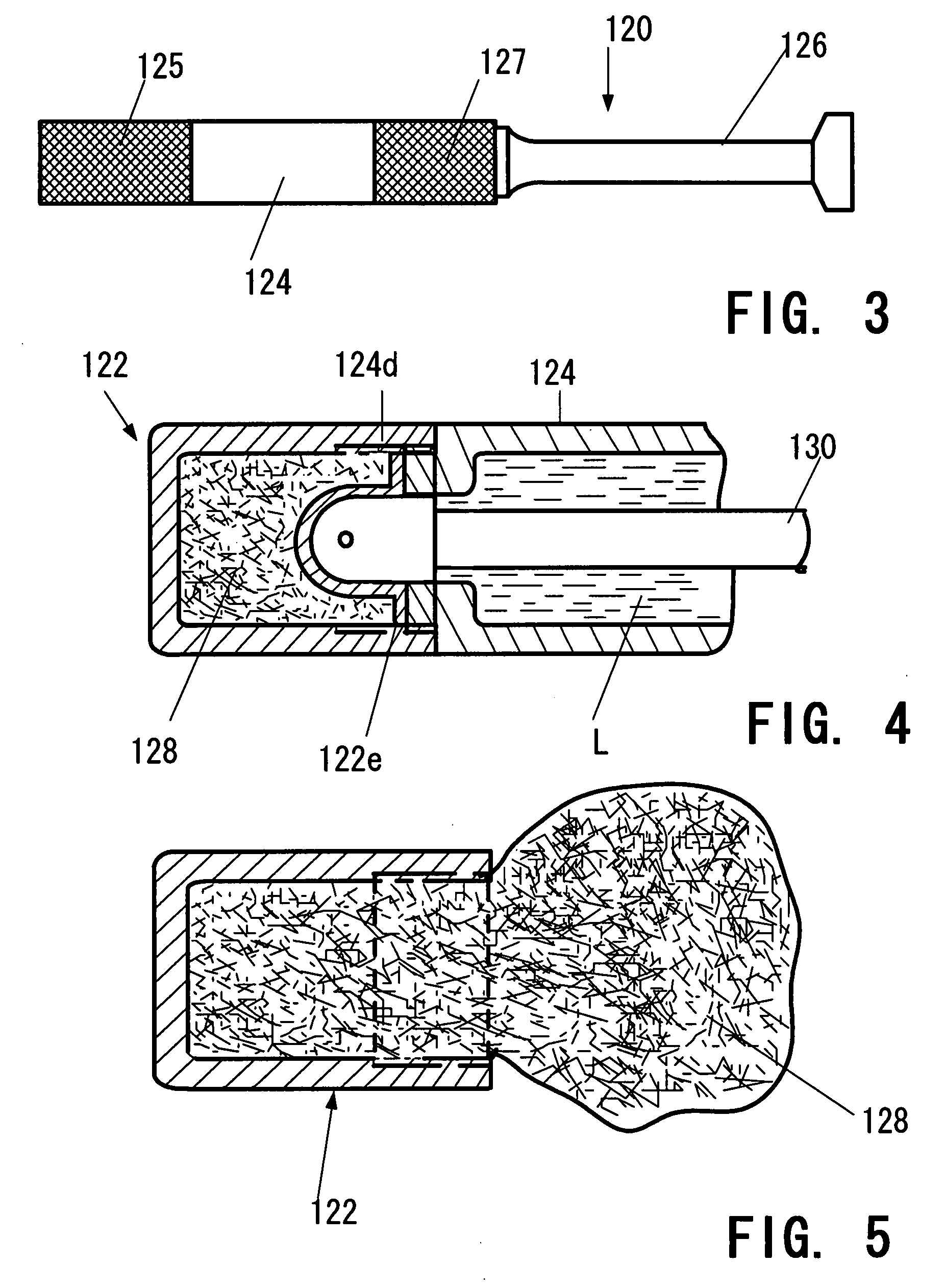 Urethral catheter assembly for combining catheterization with injection of therapeutic liquid into the urethral channel