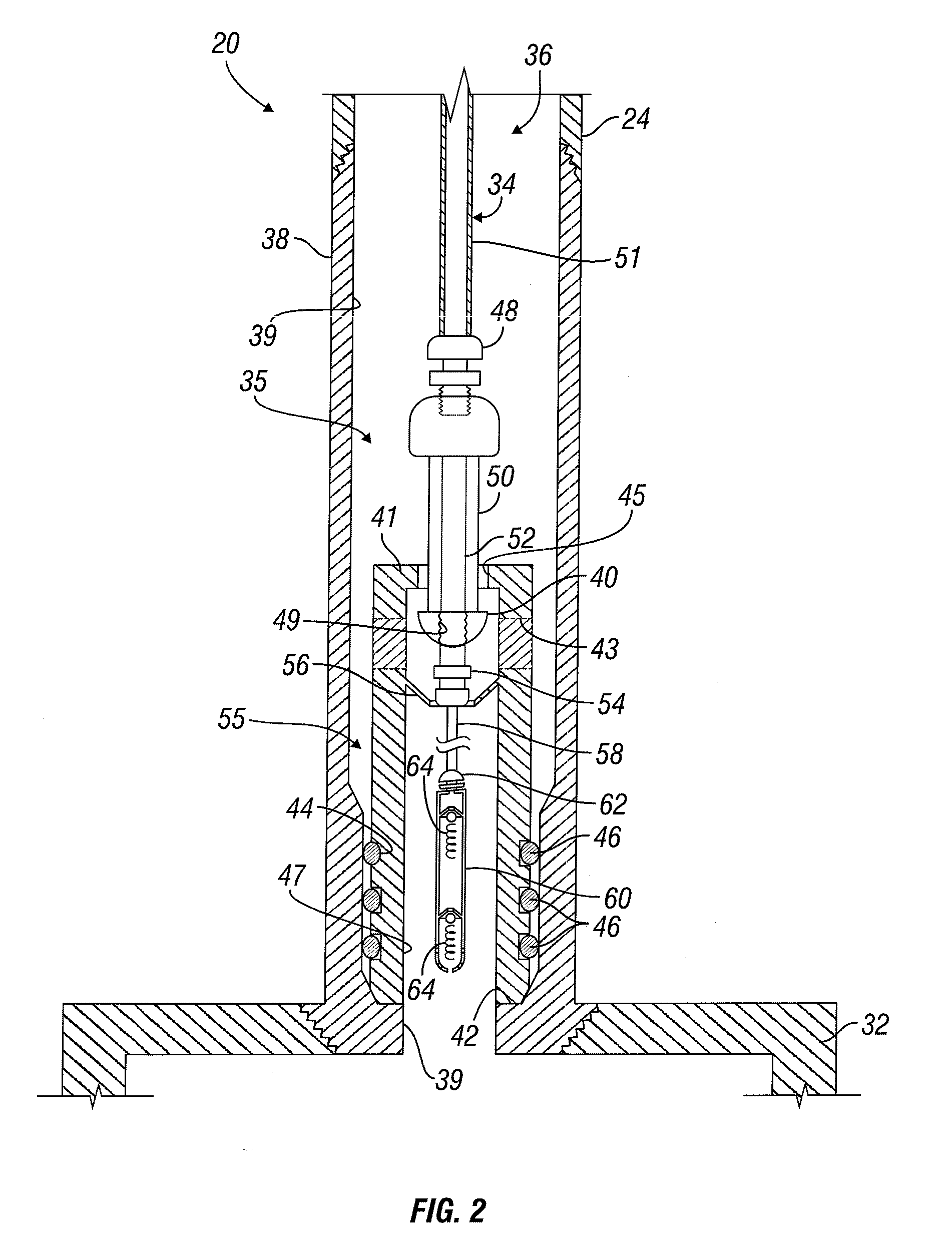 Dead string completion assembly with injection system and methods
