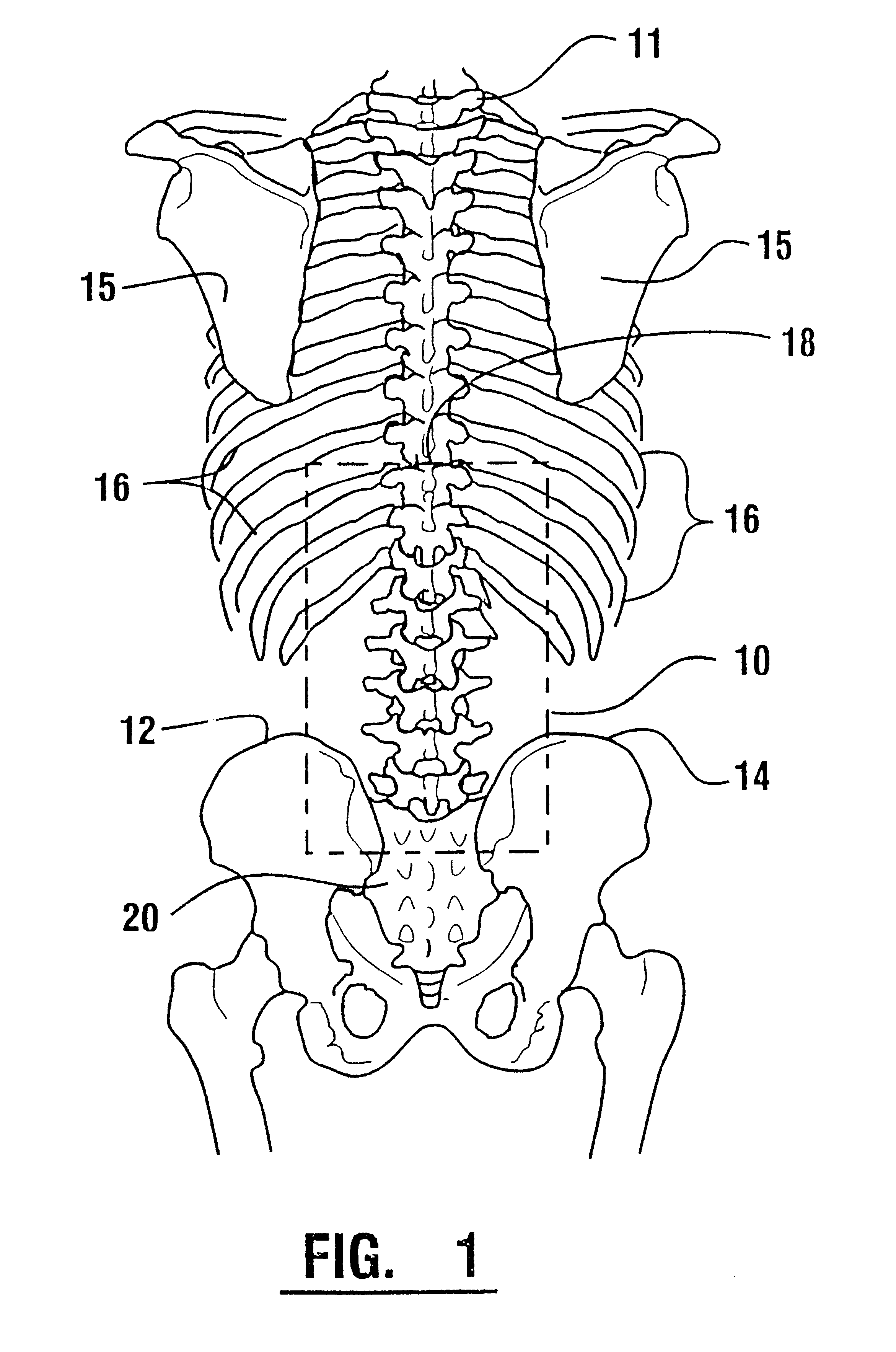 Emg electrode apparatus and positioning system