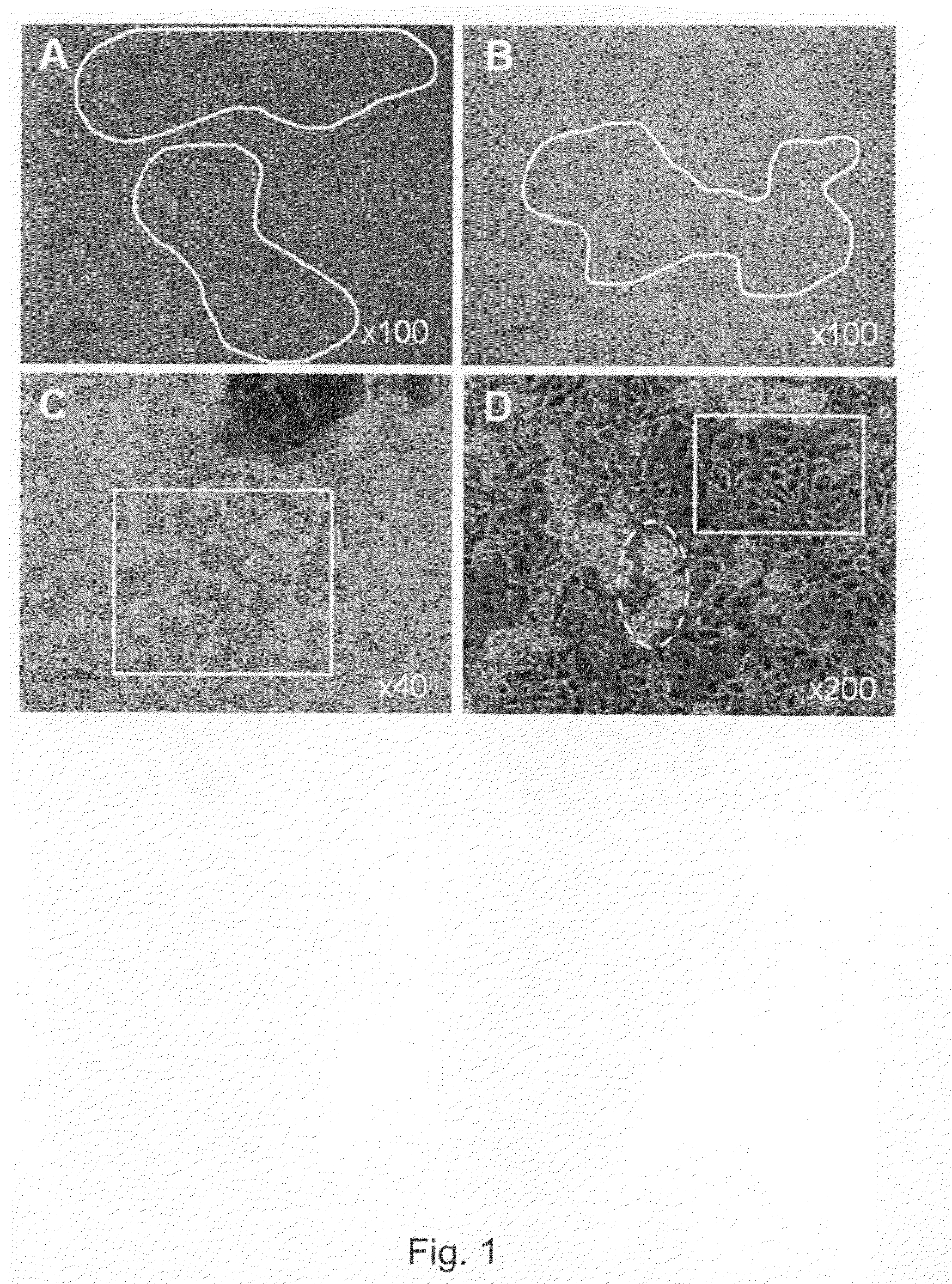 Population of multipotent cardiac precursor cells derived from human blastocysts derived stem cells